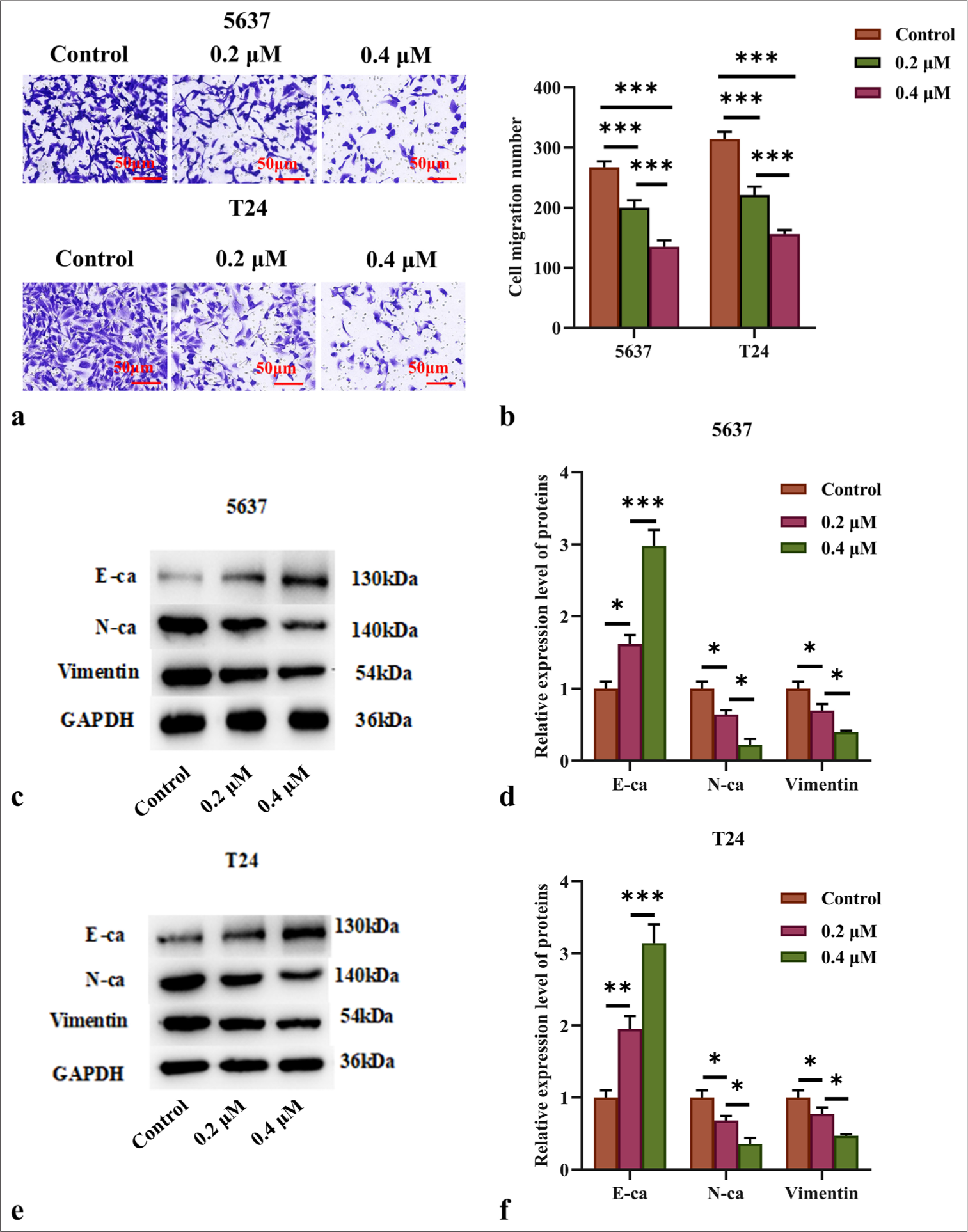 AIL suppressed the migration of BC cells. (a and b) The effect of AIL on the migration capabilities of 5637 and T24 cells was evaluated (n = 3). (c-f) The expression levels of proteins associated with EMT (E-cad, N-cad, and vimentin) were measured (n = 6). (✶P < 0.05, ✶✶P < 0.01, ✶✶✶P < 0.001). E-cad: E-cadherin, N-cad: N-cadherin, GAPDH: Glyceraldehyde-3-phosphate dehydrogenase.