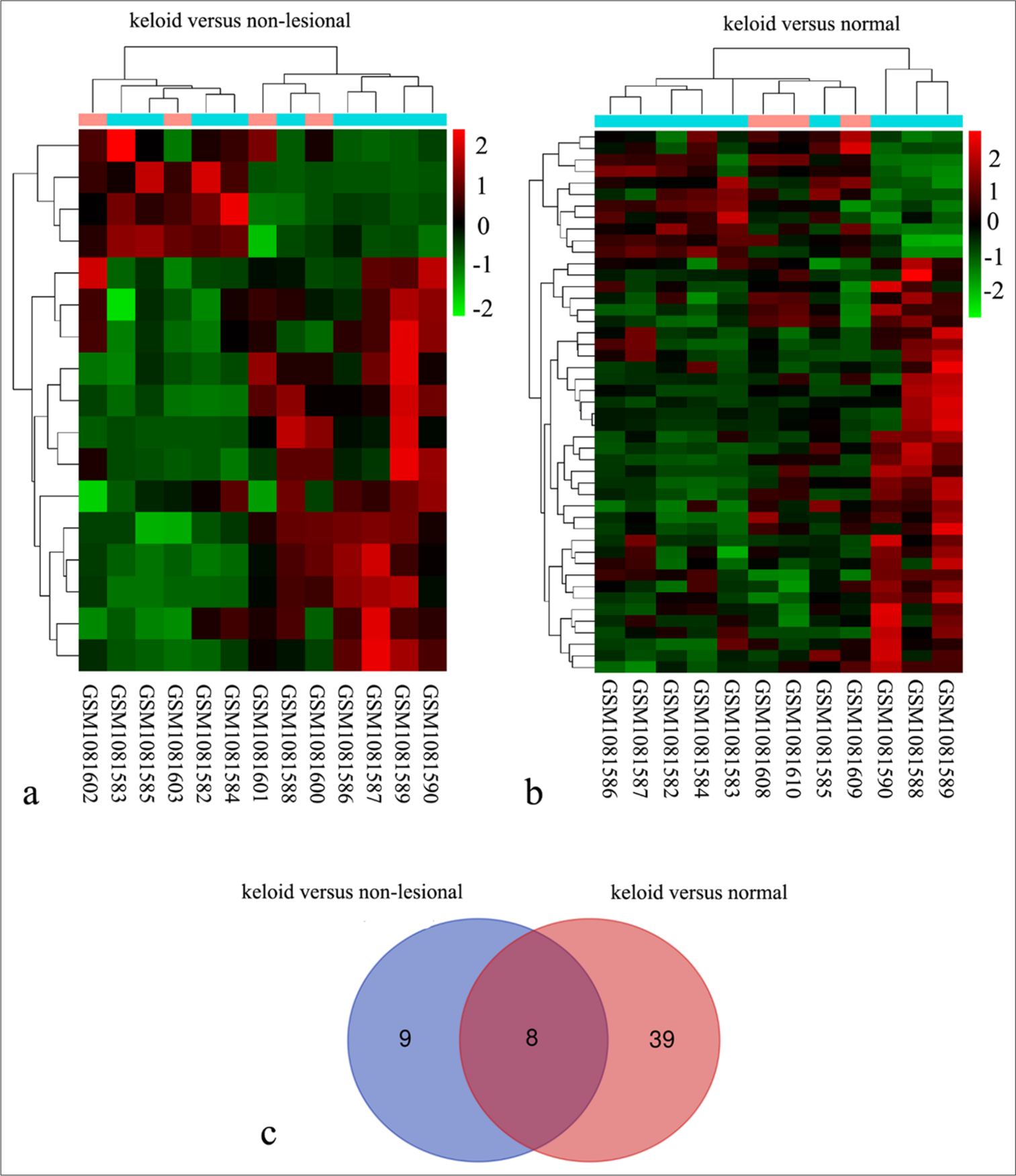 Identification of eight differentially expressed genes (DEGs) in keloid fibroblasts using the GSE44270 dataset. (a) Heat map comparing nine keloid fibroblast samples from keloid scars (GSM1081590, GSM1081586, GSM1081589, GSM1081582, GSM1081584, GSM1081583, GSM1081588, GSM1081585, and GSM1081587) with four fibroblast samples from non-lesional areas of keloid scar patients (GSM1081600, GSM1081601, GSM1081602, and GSM1081603). (b) Heat map comparing the same nine keloid fibroblast samples with three normal fibroblast samples from healthy skin (GSM1081608, GSM1081609, and GSM1081610). (c) Venn analysis revealed eight common DEGs identified between two comparisons: Keloid versus non-lesional and keloid versus normal.