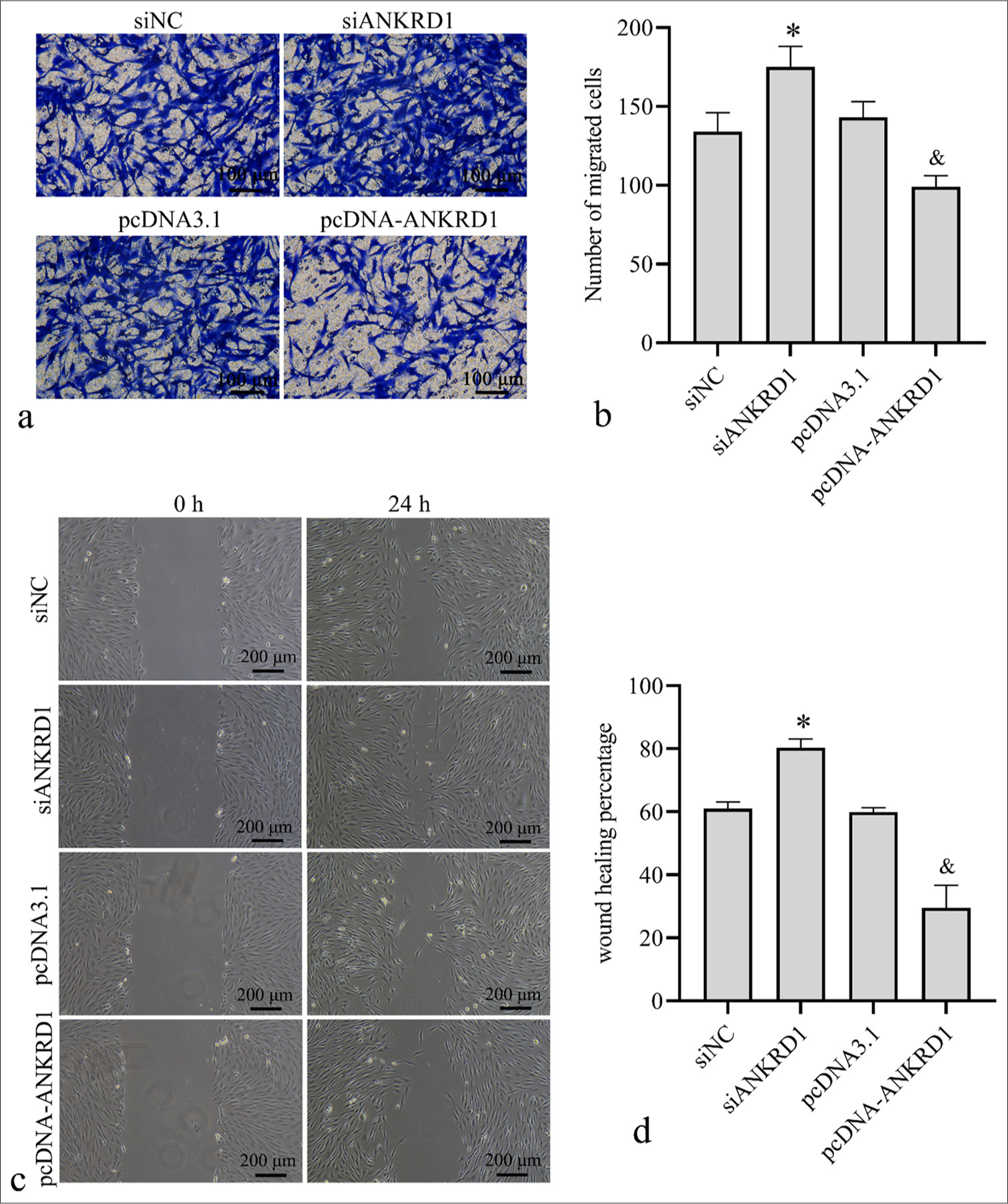 Effect of Ankyrin repeat domain 1 (ANKRD1) knockdown and overexpression on human keloid fibroblast (HKFs) cell migration. HKFs were transfected with negative control siRNA (siNC), siRNA targeting ANKRD1 (siANKRD1), empty vector pcDNA3.1, and ANKRD1 overexpression vector pcDNA-ANKRD1. After 24 h of transfection, cells were used for Transwell migration and scratch assays. (a) Images of Transwell migration assay (20×). (b) Statistical analysis of the number of migrated cells. (c) Images of wound healing captured 24 h post-scratch. (d) Statistical analysis of the percentage of wound healing. A one-way analysis of variance was used to analyze the statistical differences, n = 3. ✶P < 0.05 when compared to siNC; and, P < 0.05 when compared to pcDNA3.1. siRNA: Small interfering RNA.