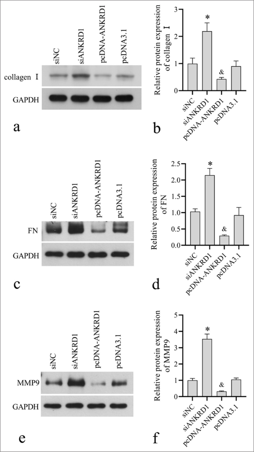 Effect of Ankyrin repeat domain 1 (ANKRD1) knockdown and overexpression on the expression of collagen I, fibronectin (FN), matrix metallopeptidase 9 (MMP9). Human keloid fibroblasts were transfected with negative control siRNA (siNC), siRNA targeting ANKRD1 (siANKRD1), empty vector pcDNA3.1, and ANKRD1 overexpression vector pcDNA-ANKRD1. After 48 h of transfection, cells were harvested for Western blotting to detect collagen I (a, b), FN (c, d), and MMP9 (e, f) expression. Panels a, c, and e are the images of Western blot . (d-f) Panels b, d, and f are the statistical analysis of relative proteinexpression normalized to glyceraldehyde-3-phosphate dehydrogenase. A one-way analysis of variance was used to analyses the statistical difference, n = 3. ✶P < 0.05 when compared to siNC; and, P < 0.05 when compared to pcDNA3.1. siRNA: Small interfering RNA.