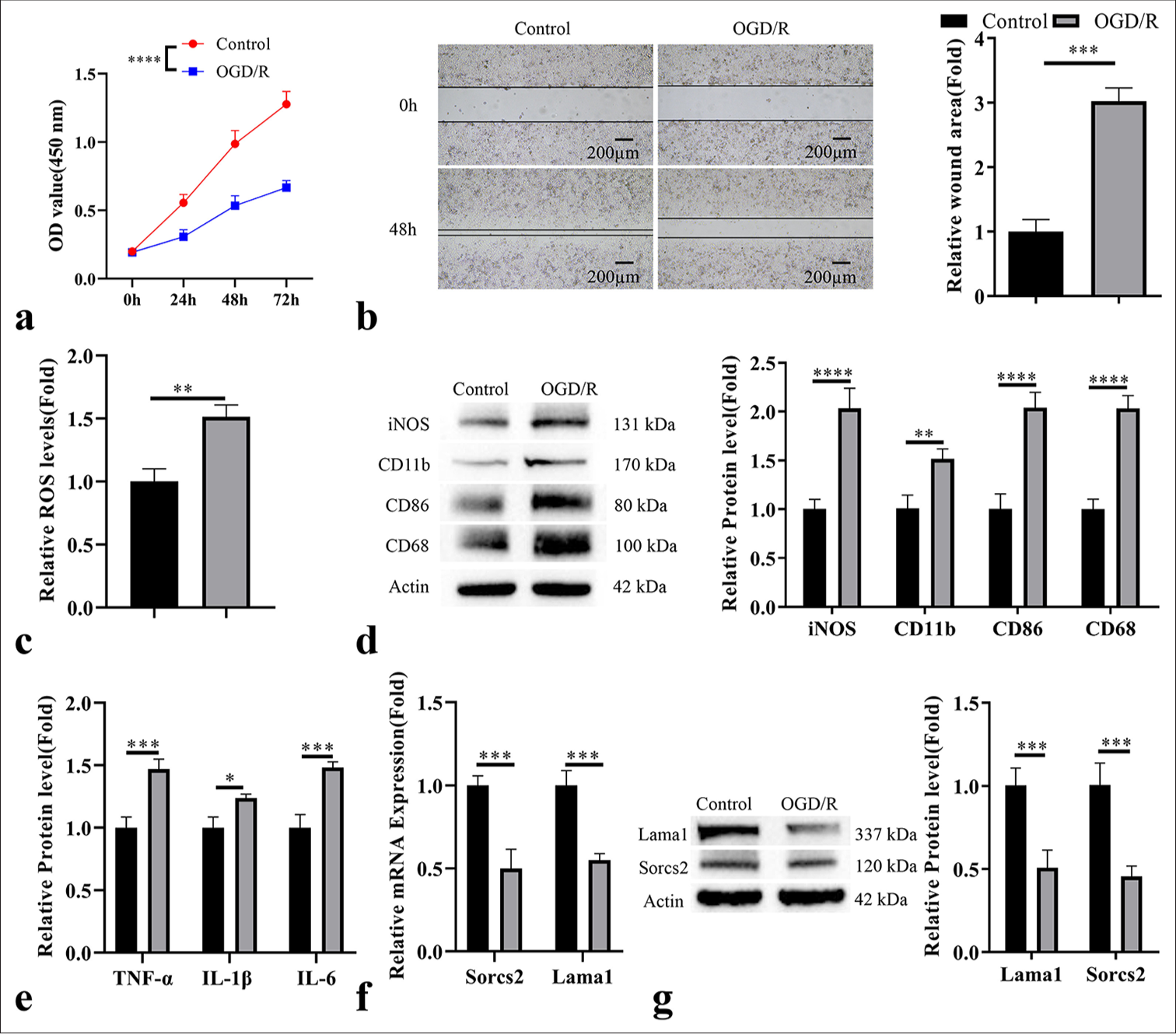 Oxygen-glucose deprivation/reperfusion (OGD/R) induces the downregulation of sortilin-related vacuolar protein sorting 10 domain containing receptor 2 (Sorcs2)/laminin subunit alpha 1 (Lama1) and promotes M1 activation of microglia cells. OGD/R was applied in HAPI cells (rat microglia cells) as a cell model of retinal ischemia-reperfusion. (a) Cell counting kit-8 proliferation assay, (b) Wound-healing migration assay, (c) reactive oxygen species level detection, (d) Western blot analysis of microglia activation markers (inducible nitric oxide synthase, cluster of differentiation [CD]11b, CD86 and CD68), (e) enzyme-linked immunosorbent assay analysis of pro-inflammatory cytokines, (f) real-time quantitative polymerase chain reaction analysis of Sorcs2 and Lama1, and (g) Western blot analysis of Sorcs2 and Lama1 in the control and OGD/R induction groups. n = 3. ✶P < 0.05; ✶✶P < 0.01; ✶✶✶P < 0.001; ✶✶✶✶P < 0.0001. TNF-α: Tumor necrosis factor alpha, IL: Interleukin, ROS: Reactive oxygen species, iNOS: Inducible nitric oxide synthase, OD value: Optical density value.