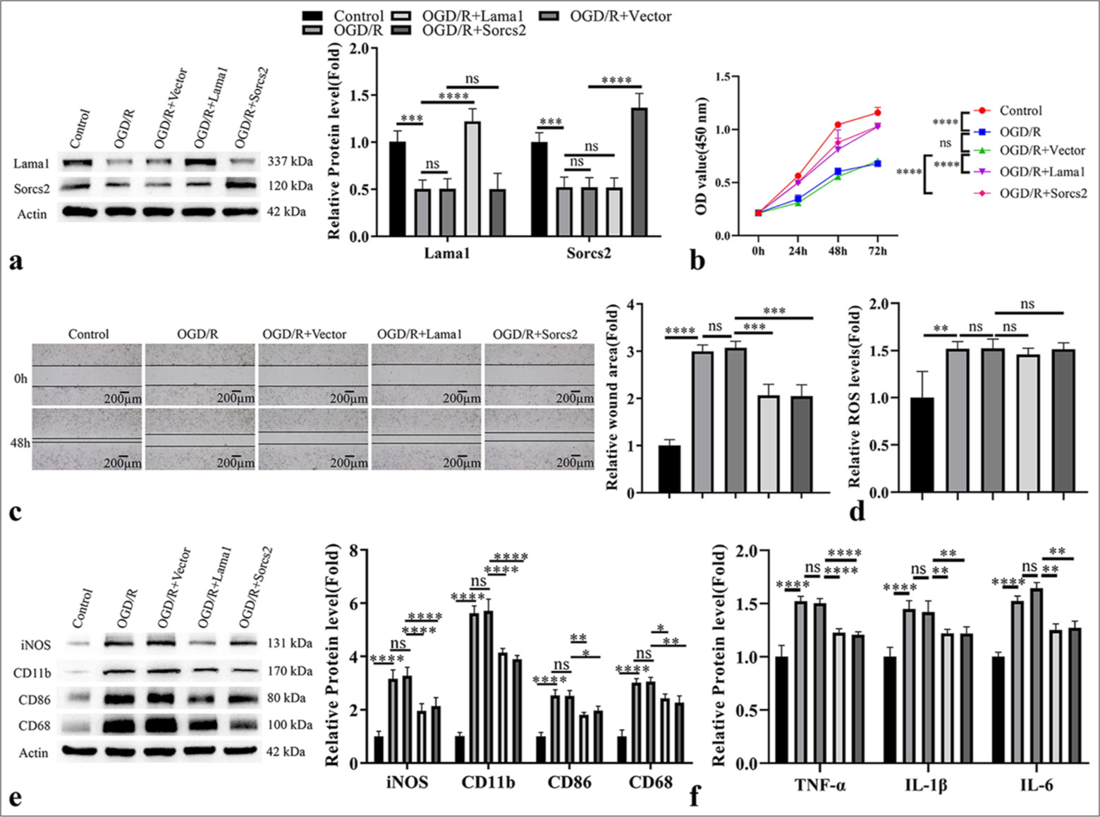 Sortilin-related vacuolar protein sorting 10 domain containing receptor 2 (Sorcs2)/laminin subunit alpha 1 (Lama1) overexpression suppresses oxygen-glucose deprivation/reperfusion (OGD/R)-induced M1 activation in microglia. HAPI cells were transduced with the lentivirus carrying empty vector, Lama1 or Sorcs2 expression sequence, and cells in different groups were subjected to OGD/R induction. (a) Western blot analysis of Lama1 and Sorcs2; (b) cell counting kit-8 proliferation assay; (c) Wound-healing migration assay; (d) reactive oxygen species level detection; (e) Western blot analysis of microglia activation markers (inducible nitric oxide synthase, cluster of differentiation [CD]11b, CD86 and CD68); (f) Enzyme-linked immunosorbent assay analysis of pro-inflammatory factors. n = 3. ✶P < 0.05; ✶✶P < 0.01; ✶✶✶P < 0.001; ✶✶✶✶P < 0.0001. TNF-α: Tumor necrosis factor alpha, IL: Interleukin, ROS: Reactive oxygen species, iNOS: Inducible nitric oxide synthase, OD value: Optical density value.