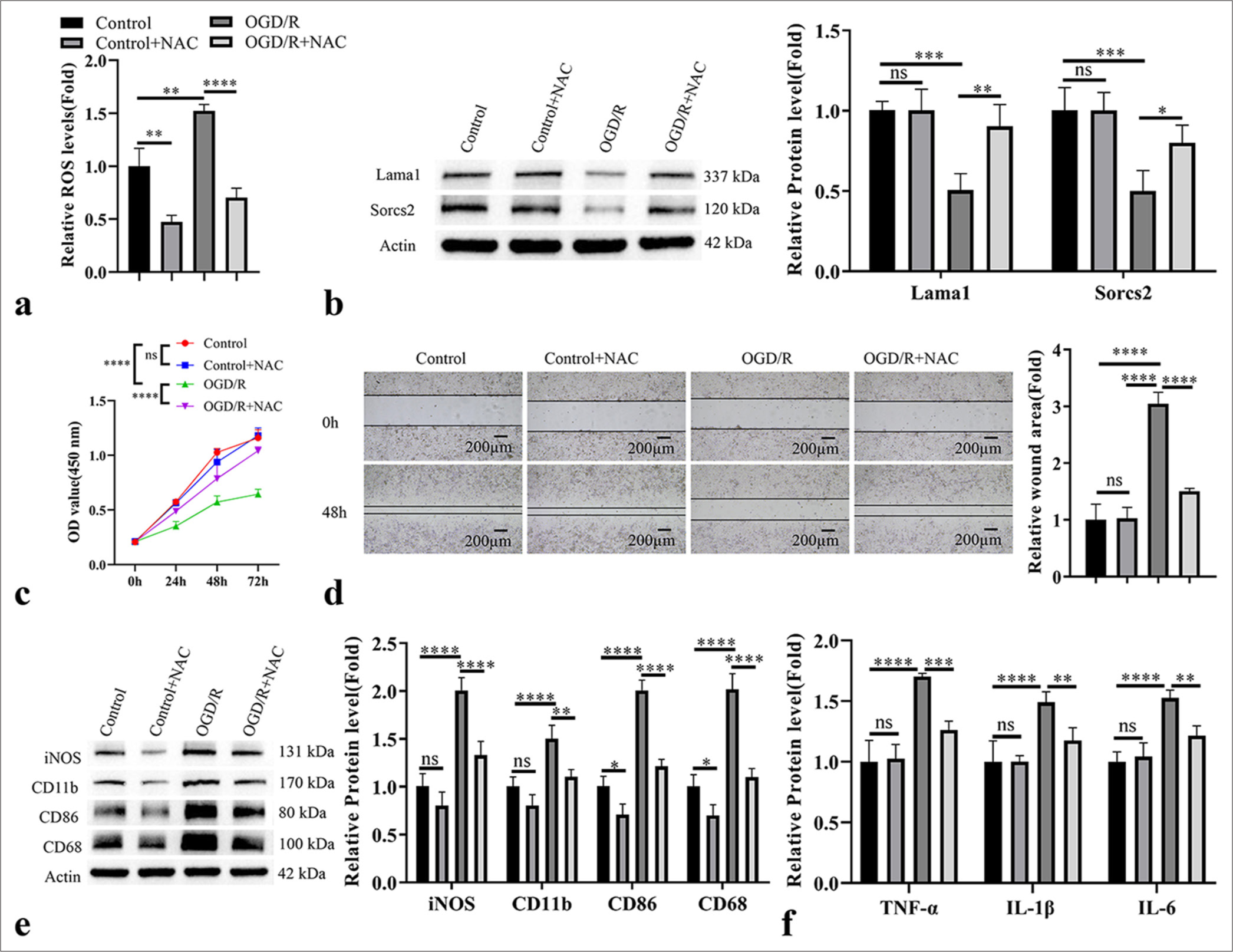 Oxygen-glucose deprivation/reperfusion (OGD/R)-induced reactive oxygen species (ROS) production mediates the expression of sortilin-related vacuolar protein sorting 10 domain containing receptor 2 (Sorcs2) and laminin subunit alpha 1 (Lama1) in M1 activation of microglia cells. N-Acetylcysteine (1 mM, antioxidant) was applied to neutralize OGD/R-induced ROS in HAPI cells for 24 h. (a) ROS level detection; (b) Immunoblotting analysis of Sorcs2 and Lama1 expression; (c) cell counting kit-8 proliferation assay; (d) Wound-healing migration assay; (e) Western blot analysis of microglia activation markers (inducible nitric oxide synthase, cluster of differentiation [CD]11b, CD86 and CD68); (f) Enzyme-linked immunosorbent assay analysis of pro-inflammatory factors. n = 3. ✶P < 0.05; ✶✶P < 0.01; ✶✶✶P < 0.001; ✶✶✶✶P < 0.0001. TNF-α: Tumor necrosis factor alpha, IL: Interleukin, iNOS: Inducible nitric oxide synthase, NAC: N-acetylcysteine, OD value: Optical density value.