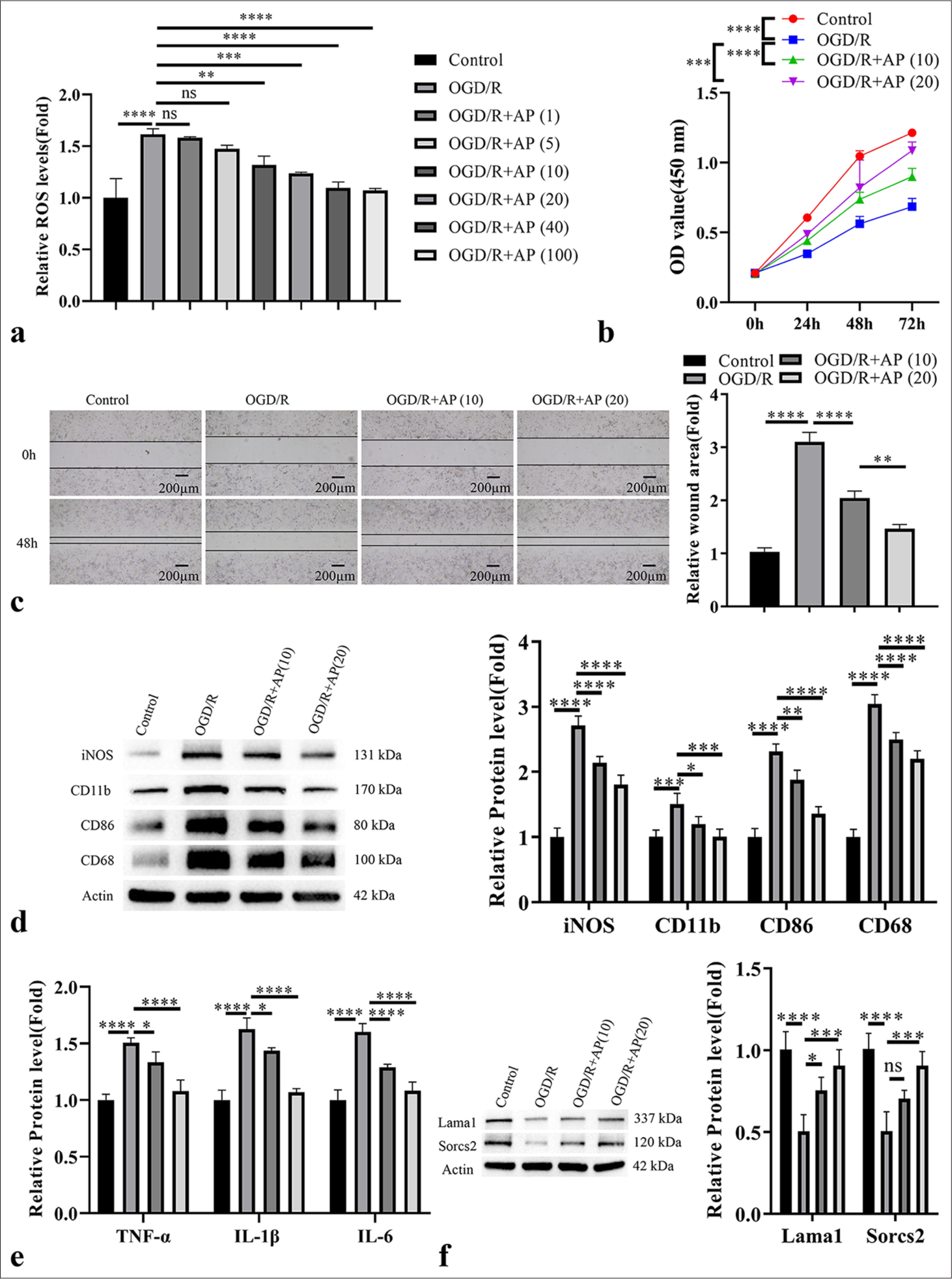 Astragalus polysaccharide (AP) shows antioxidant effect and suppresses Oxygen-glucose deprivation/reperfusion (OGD/R)-induced M1 activation in microglia cells. In OGD/R-induced HAPI cells, AP was applied at different concentration (10–100 μg/mL) for 24 h. (a) The detection of reactive oxygen species (ROS) level; (b) Cell counting kit-8 (CCK8) proliferation assay; (c) Wound-healing migration assay; (d) Western blot analysis of microglia activation markers (inducible nitric oxide synthase [iNOS], cluster of differentiation [CD]11b, CD86 and CD68); (e) Enzyme-linked immunosorbent assay analysis of pro-inflammatory mediators. (f) Western blot analysis of laminin subunit alpha 1 and sortilin-related vacuolar protein sorting 10 domain containing receptor 2. n = 3. ✶P < 0.05; ✶✶P < 0.01; ✶✶✶P < 0.001; ✶✶✶✶P < 0.0001. TNF-α: Tumor necrosis factor alpha, IL: Interleukin, Lama1: Laminin subunit alpha 1, Sorcs2: Sortilin related vacuolar protein sorting 10 domain containing receptor 2, OD value: Optical density value.