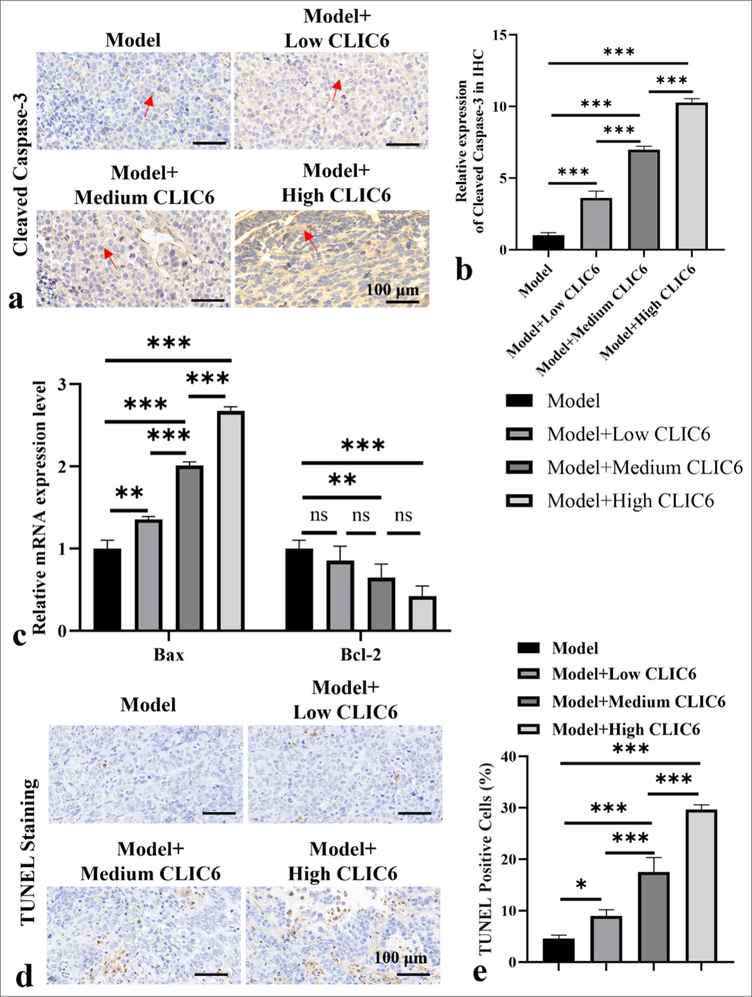 CLIC6 enhanced apoptosis of hepatocellular carcinoma cells. (a and b) Immunohistochemistry staining of cleaved caspase-3. Scale bar: 100 μm. (c) mRNA levels of Bcl-2 and Bax in tumor tissues. (d and e) TUNEL staining, objectve: 200×, detection of apoptosis level in mice liver cancer tumor tissues. Scale bar: 100 μm. n = 3 (ns: No significant difference; ✶P < 0.05, ✶✶P < 0.01, and ✶✶✶P < 0.001). CLIC6: Chloride intracellular channel 6, TUNEL: Terminal deoxynucleotidyl transferase-mediated dUTP nick-end labeling, Bcl-2: B-cell lymphoma-2, BAX: Bcl-2-associated X, mRNA: messenger RibonucleicAcid.