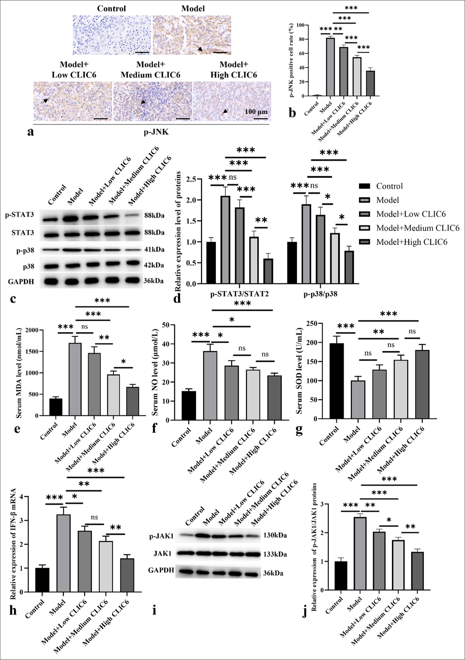 CLIC6 is involved in p-JNK-mediated oxidant stress. (a and b) Immunohistochemistry staining, objectve: 200×, of p-JNK. Scale bar: 100 μm. (c and d) Expression levels of p-STAT3 and p-p38 proteins in liver. (e-g) Serum levels of MDA (e), NO (f), and SOD(g). (h) IFN-β mRNA levels in liver. (i and j) Protein expression levels of JAK1 and p-JAK1. n = 3 (ns: No significant difference; ✶P < 0.05, ✶✶P < 0.01, and ✶✶✶P < 0.001). CLIC6: Chloride intracellular channel 6, JAK: Janus tyrosine kinase, STAT: Signal transducer and activator of transcription, p38: P38 mitogen-activated protein kinase, IFN: Interferon, p-JNK: phosphor-c-Jun N-terminal kinase, MDA: Malondialdehyde, SOD: Super Oxide Dismutase.