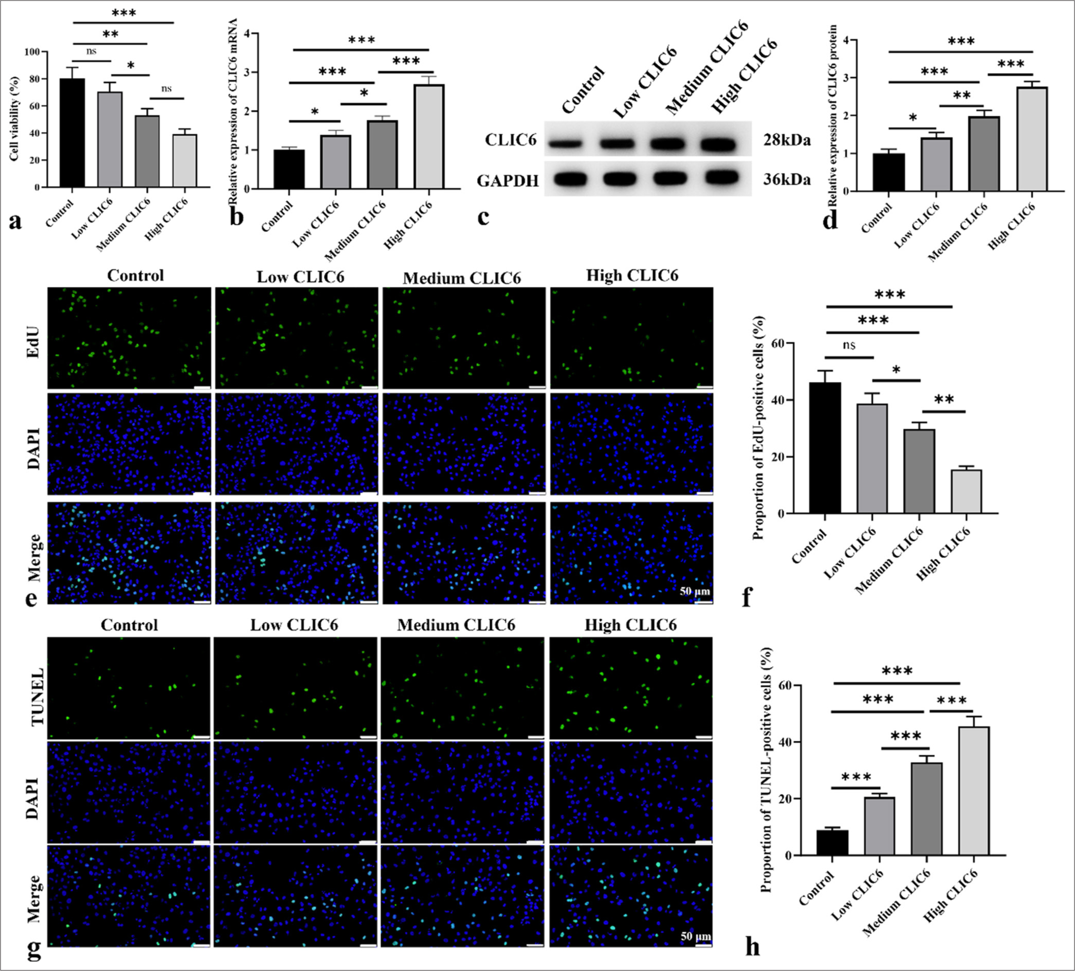 CLIC6 suppressed proliferation of HepG2 cells and induced apoptosis. (a) Activity of HepG2 cells treated with different doses of CLIC6 recombinant protein. (b-d) Levels of CLIC6 in cells were analyzed by Western Blot and qRT-PCR. (e and f) EdU staining, objectve: 200×, was used to analyze the effects of different doses of CLIC6 recombinant protein on the proliferation capacity of HepG2 cells. Scale bar: 50 μm. (g and h) Cell apoptosis measured using TUNEL staining, objectve: 200×, after treating HepG2 cells with different doses of CLIC6 recombinant protein. Scale bar: 50 μm. n = 3 (ns: No significant difference; ✶P < 0.05, ✶✶P < 0.01, and ✶✶✶P < 0.001). CLIC6: Chloride intracellular channel 6, EdU: 5-ethynyl-2'-deoxyuridine, DAPI: 4',6-diamidino-2'-phenylindole, qRT-PCR: Quantitative real-time polymerase chain reaction, TUNEL: Terminal deoxynucleotidyl transferase-mediated dUTP nick-end labeling.