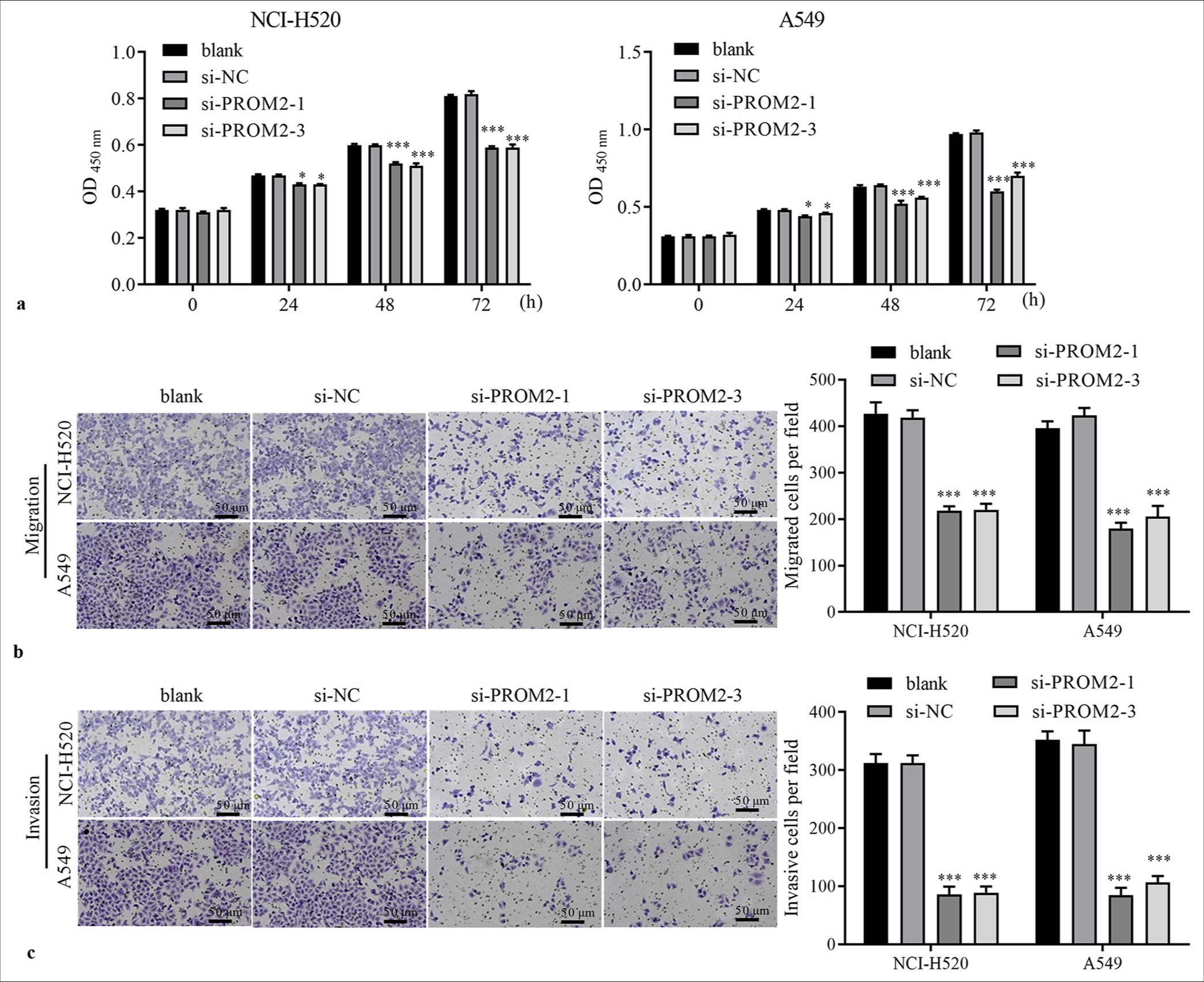 Function of PROM2 silencing in NSCLC cells. (a) The proliferation of NCI-H520 and A549 transfected with si-PROM2 or si-NC was examined using the CCK-8 assay. (b and c) The migration and invasiveness of NSCLC cells transfected with si-PROM2 or si-NC were evaluated using Transwell assays (Crystal violet stain, ×100). n = 3. Data are shown as means ± standard deviation. One-way ANOVA was utilized to analyze differences. (✶P < 0.05 and ✶✶✶P < 0.001, vs. si-NC). PROM2: Prominin 2, NSCLC: Non-small cell lung cancer, CCK-8: Cell counting kit-8, ANOVA: Analysis of variance, si-PROM2: siRNAs against PROM2; si-NC: siRNAs against negative control.