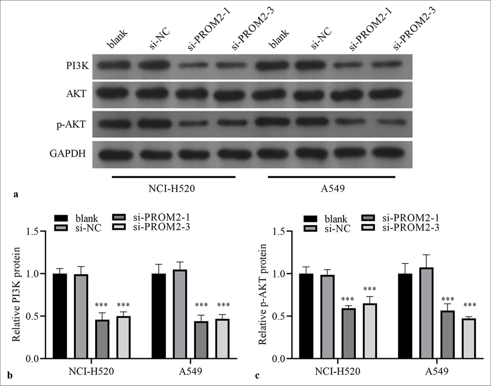 PI3K and p-AKT/AKT protein in the two kinds of NSCLC cells after PROM2 silencing were evaluated. (a) PI3K protein and p-AKT/AKT were measured by employing Western blot analysis. (b–c) Histogram representing PI3K and p-AKT protein levels. n = 3. Data are shown as means ± standard deviation. One-way ANOVA was utilized to analyze differences. (✶✶✶P < 0.001, vs. si-NC). PROM2: Prominin 2, NSCLC: Non-small cell lung cancer, PI3K: Phosphatidylinositol 3 kinase, AKT: Protein kinase B, p-AKT: PhosphorylatedAKT protein, ANOVA: Analysis of variance.