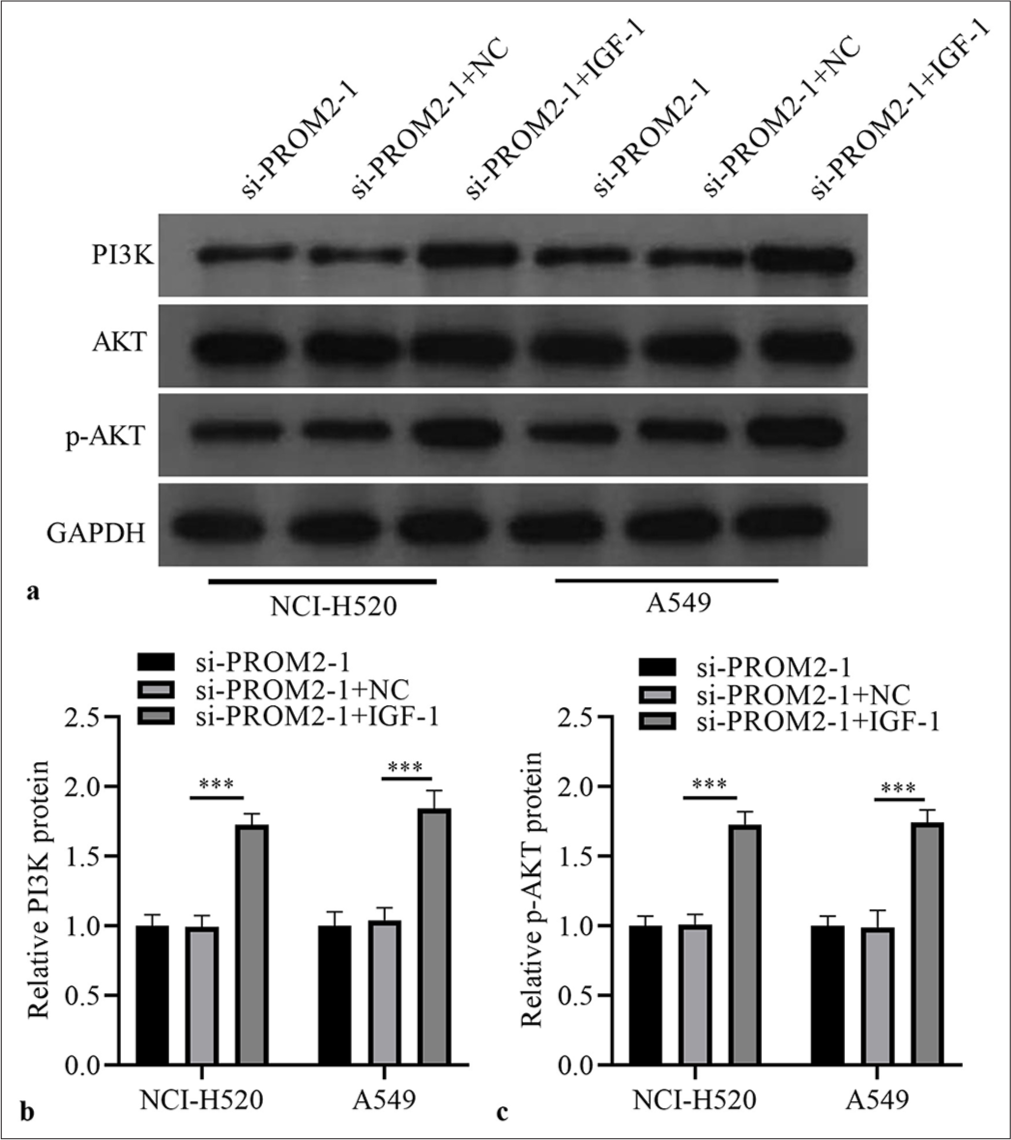 IGF-1 activated PA-P in PROM2-silenced NSCLC cells. (a) Protein in the two kinds of NSCLC cells subjected to PROM2 silencing and treated with 100 ng/mL IGF-1 were evaluated through Western blot analysis. (b and c) Histogram representing PI3K and p-AKT protein levels. n = 3. Data are shown as means ± standard deviation. One-way ANOVA was utilized to analyze the differences. (✶✶✶P < 0.001). PROM2: Prominin 2, NSCLC: Non-small cell lung cancer, PI3K: Phosphatidylinositol 3 kinase, AKT: Protein kinase B, p-AKT: Phosphorylated-AKT protein, IGF-1: Insulin-like growth factor-1, ANOVA: Analysis of variance.