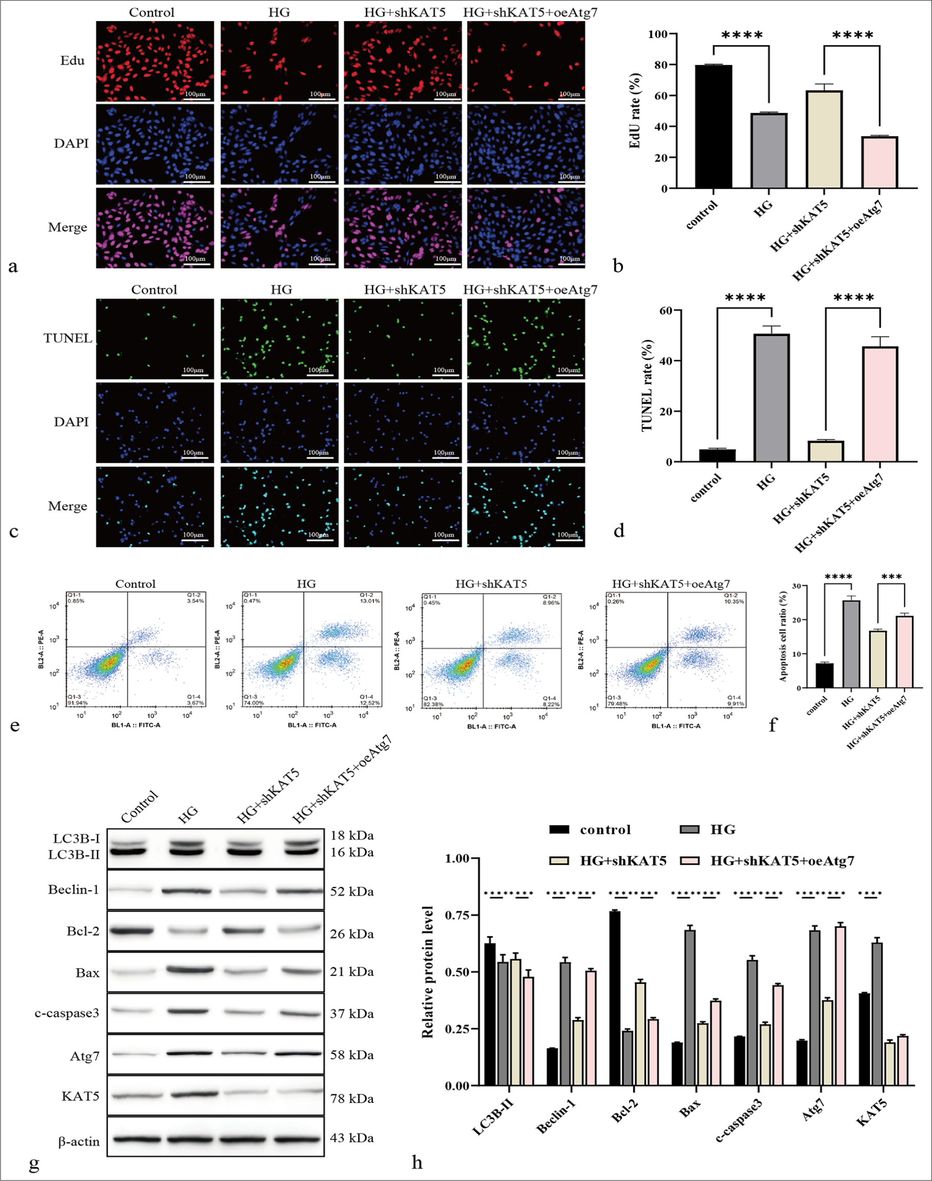 KAT5 contributes to autophagy in monkey retinal choroidal endothelial cells (RF/6A) cells under HG condition by targeting Atg7. (a and b) Cell proliferation was measured by EdU. Scale bar = 100 μm. (c and d) Cell apoptosis was evaluated using by TUNEL. Scale bar = 100 μm. (e and f) Cell apoptosis was detected by flow cytometry. (g and h) The protein levels of Atg7, KAT5, Bcl-2, Bax, c-caspase-3, Beclin-1, and LC3B were assessed through Western blot. ✶✶✶P < 0.001, ✶✶✶✶P < 0.0001. KAT5: Lysine acetyltransferase 5, Atg7: Autophagy-related protein 7, Bcl-2: B-cell lymphoma-2, Bax: BCL-2-associated X protein, c-caspase-3: Cleaved caspase-3, LC3B: Microtubule-associated protein 1 light chain 3B, EdU: 5-ethynyl-2’-deoxyuridine, TUNEL: Terminal deoxynucleotidyl transferase dUTP nick-end labeling.