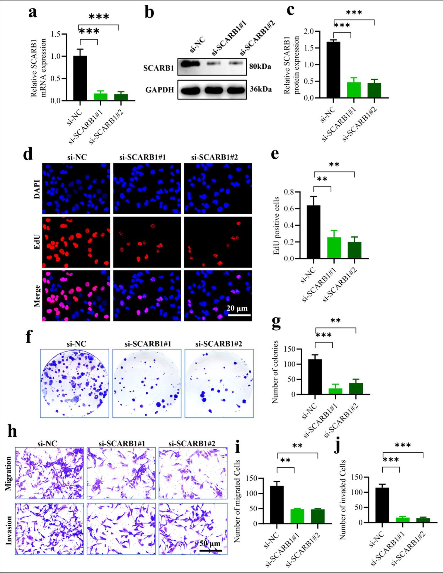 Silencing SCARB1 inhibits lung cancer cell growth. (a) qPCR validation of SCARB1 knockdown efficiency in A549 cells. (b and c). Western blot validation of SCARB1 knockdown efficiency in A549 cells. (d and e). EdU assay of A549 cell proliferation after SCARB1 knockdown. (f and g) Colony formation assay of A549 cell growth after SCARB1 knockdown. (h-j) Transwell assay of A549 cell invasion and migration after SCARB1 knockdown. n = 3. ✶✶P < 0.01, ✶✶✶P < 0.001. SCARB1: Scavenger receptor class B member 1, EdU: 5-ethynyl-2'-deoxyuridine, DAPI: 4',6-diamidino-2'-phenylindole, GAPDH: glyceraldehyde-3-phosphate dehydrogenase, qPCR: Quantitative PCR.