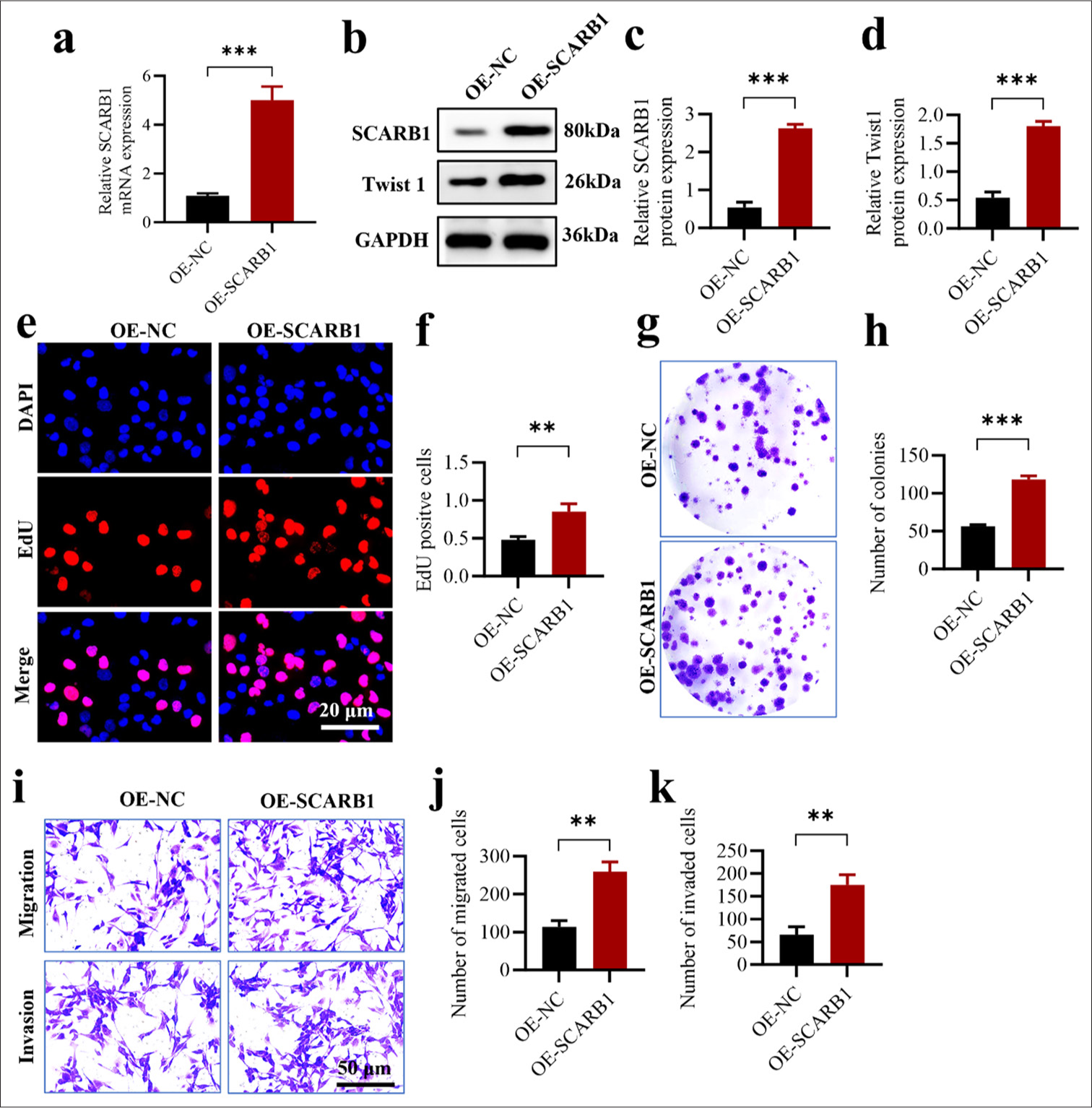 SCARB1 overexpression enhances lung cancer cell proliferation and migration by activating Twist1. (a) qPCR validation of SCARB1 overexpression efficiency in A549 cells. (b-d) Validation of SCARB1 overexpression efficiency and Twist1 upregulation in A549 cells through Western blot analysis. (e and f) EdU assay of A549 cell proliferation after SCARB1 overexpression. (g and h) Colony formation assay of A549 cell growth after SCARB1 overexpression. (i-k) Transwell assay of A549 cell invasion and migration after SCARB1 overexpression. n = 3. ✶✶P < 0.01, ✶✶✶P < 0.001. Twist1: Twist family bHLH transcription factor 1, SCARB1: Scavenger receptor class B member 1, EdU: 5-ethynyl-2'-deoxyuridine, qPCR: Quantitative PCR.