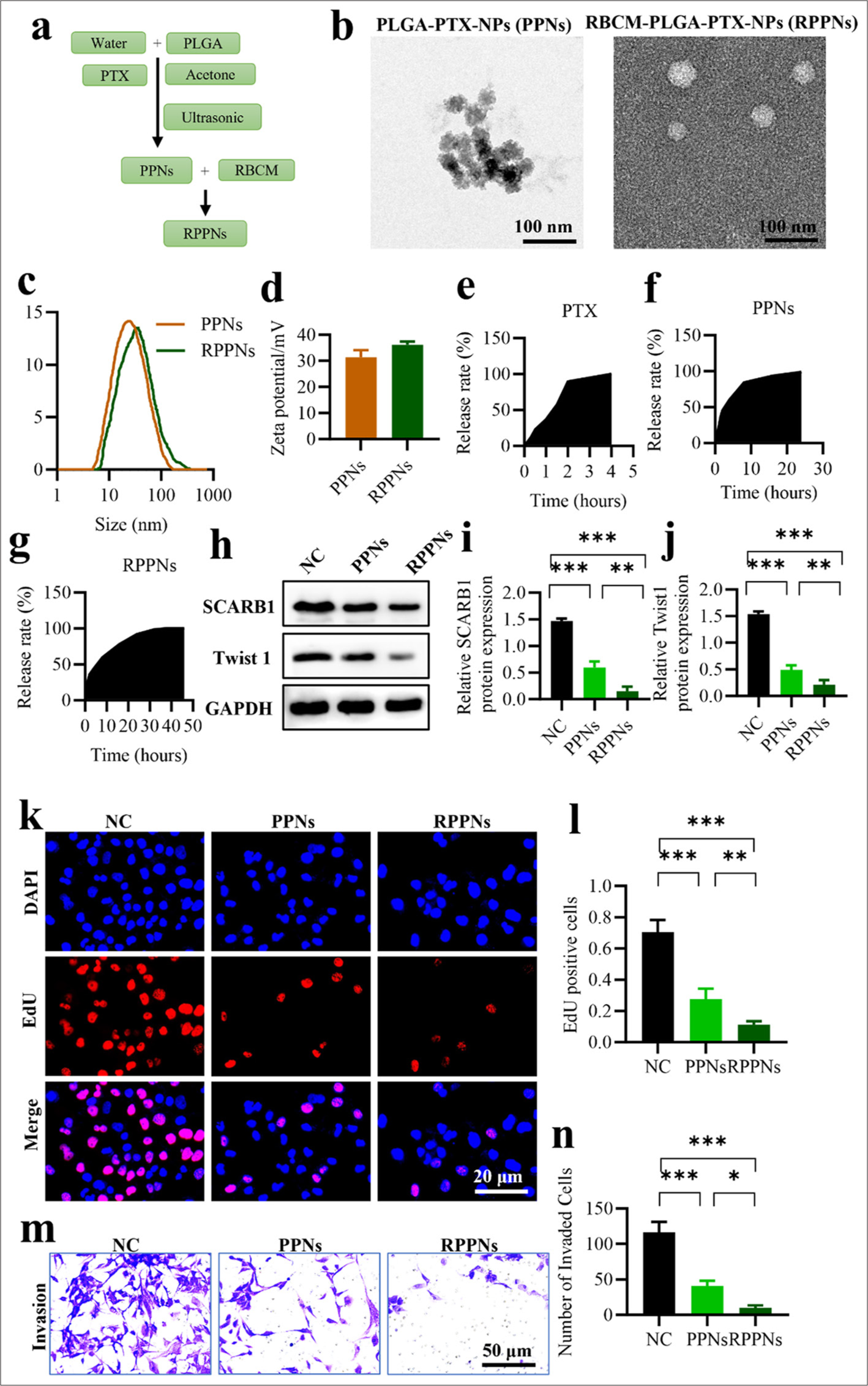 RPPNs inhibit SCARB1 expression in lung cancer with enhanced efficacy. (a) Schematic of RPPN preparation. (b) TEM images of PPNs and RPPNs. (c) Hydrodynamic size distribution of PPNs and RPPNs. (d) Zeta potential of PPNs and RPPNs. (e-g) In vitro release profiles of PTX from PPNs and RPPNs. (h-j) Western blot analysis of SCARB1 and Twist1 protein levels in A549 cells treated with PPNs or RPPNs. (k and l). EdU assay of A549 cell proliferation after treatment with PPNs or RPPNs. (m and n) Transwell assay of A549 cell invasion after treatment with PPNs or RPPNs. n = 3. ✶P < 0.05, ✶✶P< 0.01, ✶✶✶P < 0.001. RPPNs, red blood cell membrane-coated poly (lactic-co-glycolic acid) nanocarriers loaded with paclitaxel; PPNs, poly (lactic-co-glycolic acid) nanocarriers loaded with paclitaxel; PTX: Paclitaxel, Twist1: Twist family bHLH transcription factor 1, SCARB1: Scavenger receptor class B member 1, EdU: 5-ethynyl-2'-deoxyuridine, TEM: Transmission electron microscopy.