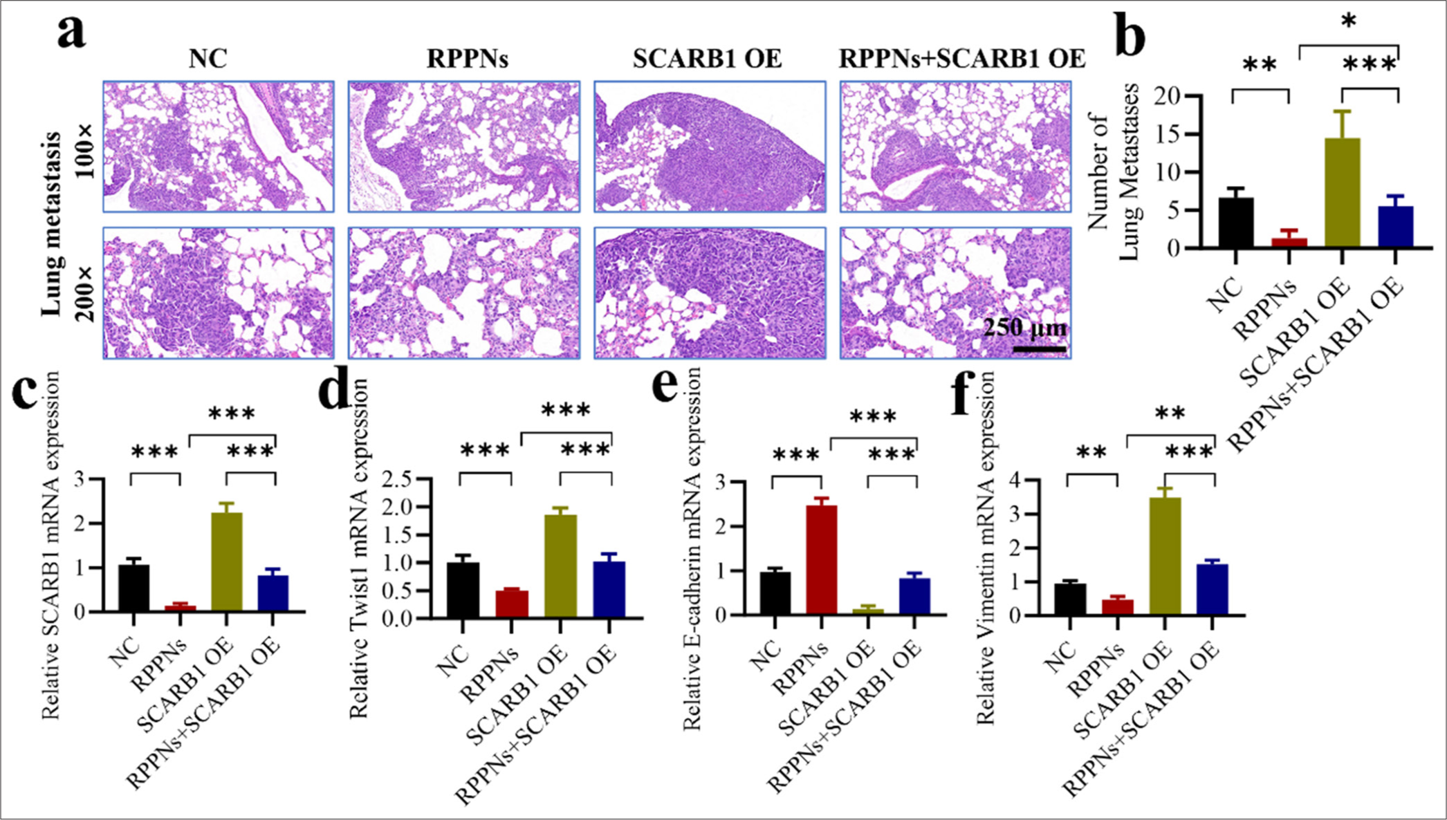 SCARB1 overexpression antagonizes the antimetastatic effects of RPPNs. (a and b) The lung metastasis model established through tail vein injection demonstrates that SCARB1 overexpression antagonizes the antitumor effects of RPPNs. (c) qRT-PCR analysis of SCARB1 expression in metastatic tumor tissues. (d) qRT-PCR analysis of Twist1 expression in metastatic tumor tissues. (e) qRT-PCR analysis of E-cadherin expression in metastatic tumor tissues. (f) qRT-PCR analysis of Vimentin expression in metastatic tumor tissues. n = 6. ✶P < 0.05, ✶✶P < 0.01, ✶✶✶P < 0.001. qRT-PCR: Quantitative real-time polymerase chain reaction, Twist1: Twist family bHLH transcription factor 1, SCARB1: Scavenger receptor class B member 1.