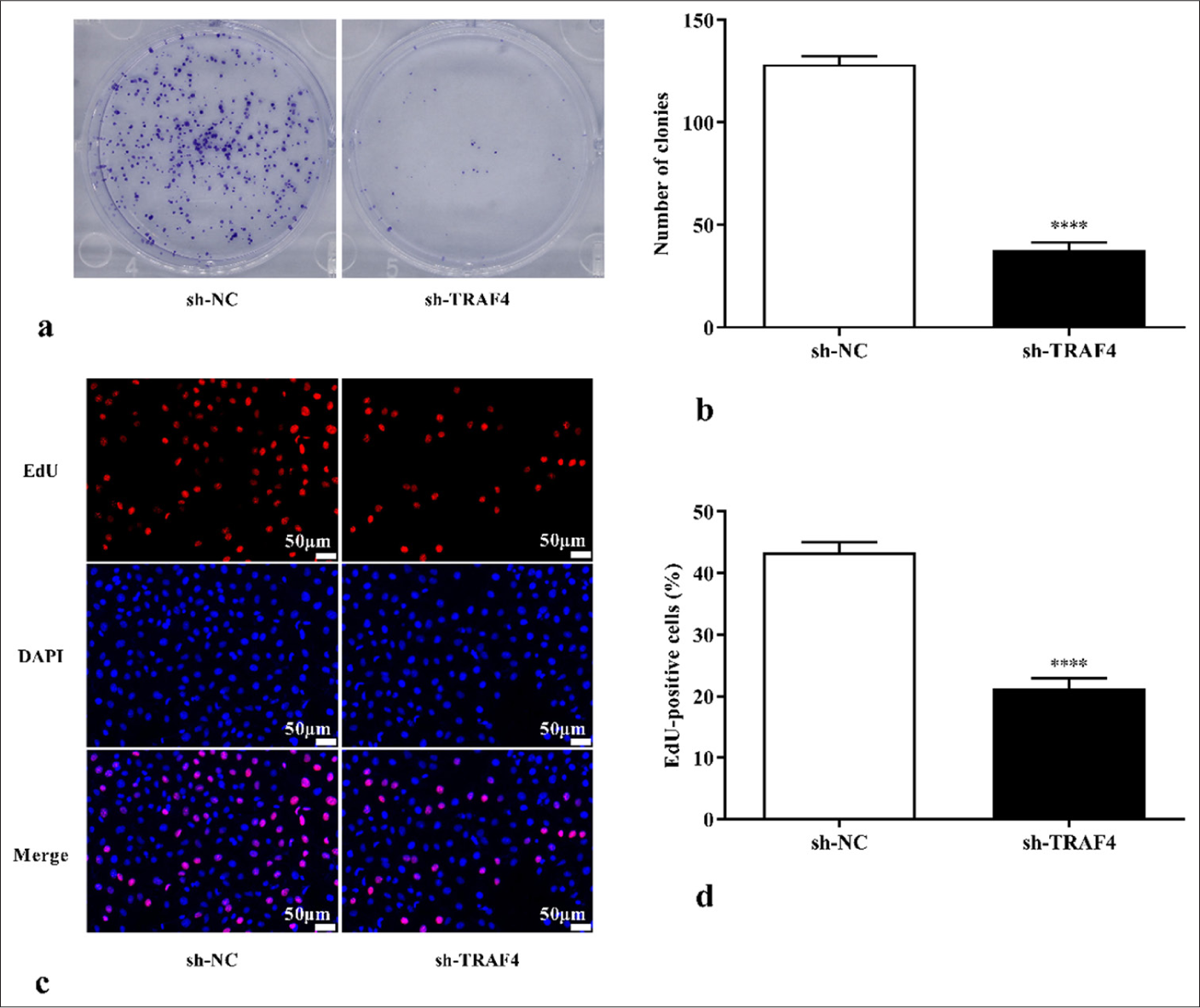 TRAF4 knockdown inhibited CRC cell proliferation. (a-d) Colony formation and EdU assay, 200×, (scale bar: 50 μm) results showing that TRAF4 knockdown inhibited CRC cell proliferation (n = 3). ✶✶✶✶P < 0.0001, versus sh-NC group. TRAF4: Tumor necrosis factor receptor-associated factor 4, EdU: 5-ethynyl-2’-deoxyuridine, DAPI: 4’-6-diamidino-2-phenylindole, NC: Negative control, sh: Short hairpin, CRC: Colorectal cancer.