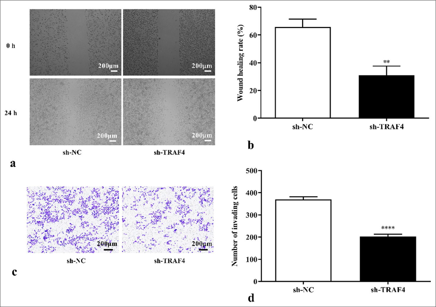 TRAF4 knockdown inhibited CRC cell migration and invasion. (a-d) Cell migration and invasion abilities were measured using scratch healing, 40×, (scale bar: 200 μm) and Transwell assays, 40×, (scale bar: 200 μm) (n = 3). ✶✶P < 0.01, ✶✶✶✶P < 0.0001, versus sh-NC group. TRAF4: Tumor necrosis factor receptor-associated factor 4, CRC: Colorectal cancer, NC: Negative control, sh: Short hairpin.