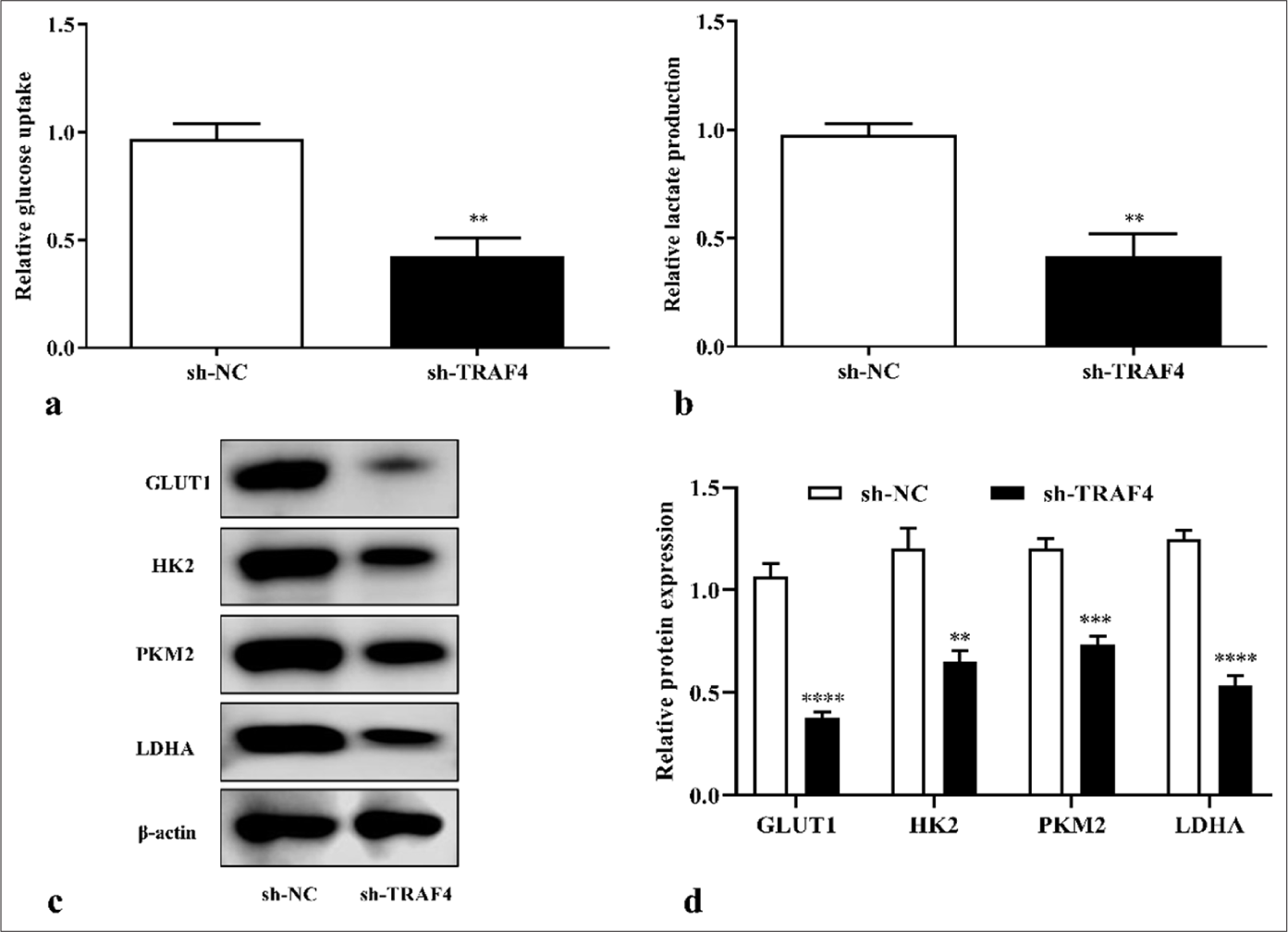 TRAF4 knockdown inhibited aerobic glycolysis of CRC cells. (a-d) TRAF4 knockdown suppressed glucose uptake, lactate production, and glycolysis-related protein expression in CRC cells (n = 3). ✶✶P < 0.01, ✶✶✶P < 0.001, ✶✶✶✶P < 0.0001, versus sh-NC group. GLUT1: Glucose transporter type 1, HK2: Hexokinase 2, LDHA: Lactate dehydrogenase A, CRC: Colorectal cancer, TRAF4: Tumor necrosis factor receptor-associated factor 4, NC: Negative control, sh: Short hairpin.