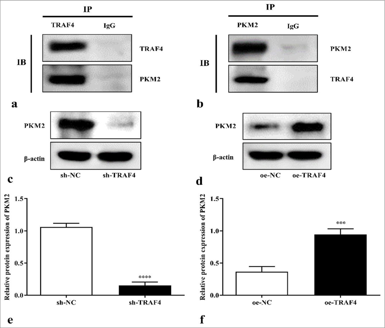 TRAF4 can interact with PKM2. (a and b) Interactions of TRAF4 and PKM2 in CRC cells were analyzed by co-immunoprecipitation (n = 3). (c-f) PKM2 protein expression in CRC cells after sh-TRAF4 or oe-TRAF4 transfection (n = 3). ✶✶✶P < 0.001, ✶✶✶✶P < 0.0001, versus sh-NC or oe-NC group. PKM2: Pyruvate kinase muscle isoform 2, CRC: Colorectal cancer, TRAF4: Tumor necrosis factor receptor-associated factor 4, oe: Overexpression, NC: Negative control, sh: Short hairpin.