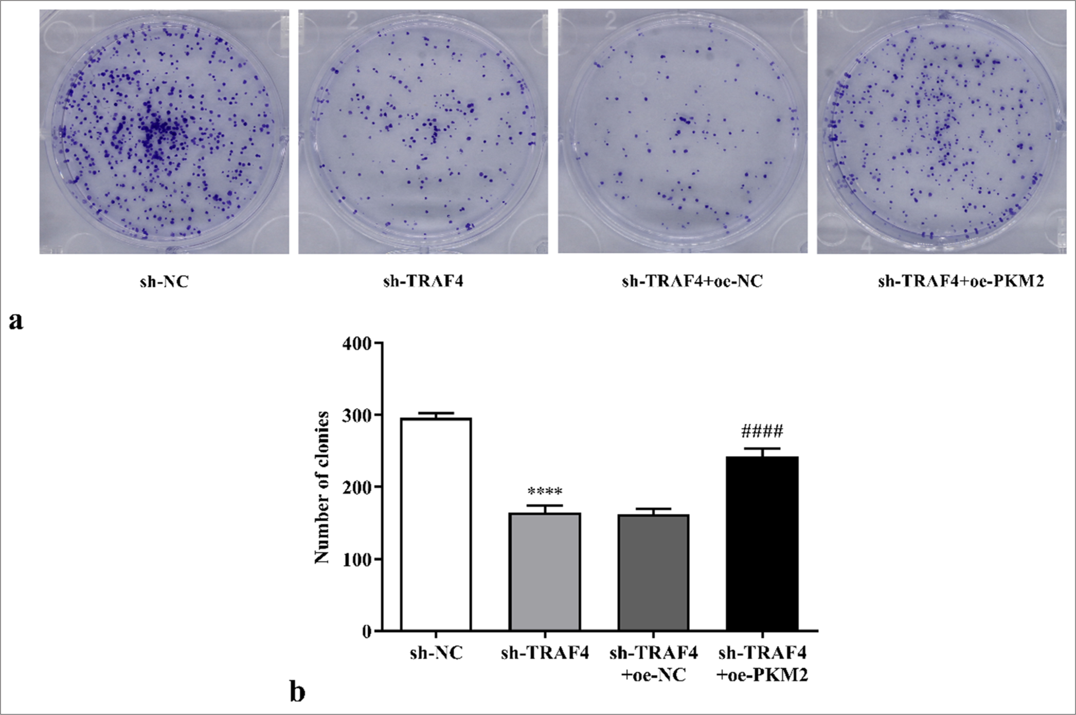 Effects of sh-TRAF4 and oe-PKM2 co-transfection on CRC cell proliferation were detected through colony formation assay (a) clone formation images and (b) statistical analysis. (n = 3). ✶✶✶✶P < 0.0001, versus sh-NC group. ####P < 0.0001, versus sh-TRAF4 + oeNC group. CRC: Colorectal cancer, TRAF4: Tumor necrosis factor receptor-associated factor 4, PKM2: Pyruvate kinase muscle isoform 2, oe: Overexpression, NC: Negative control, sh: Short hairpin.