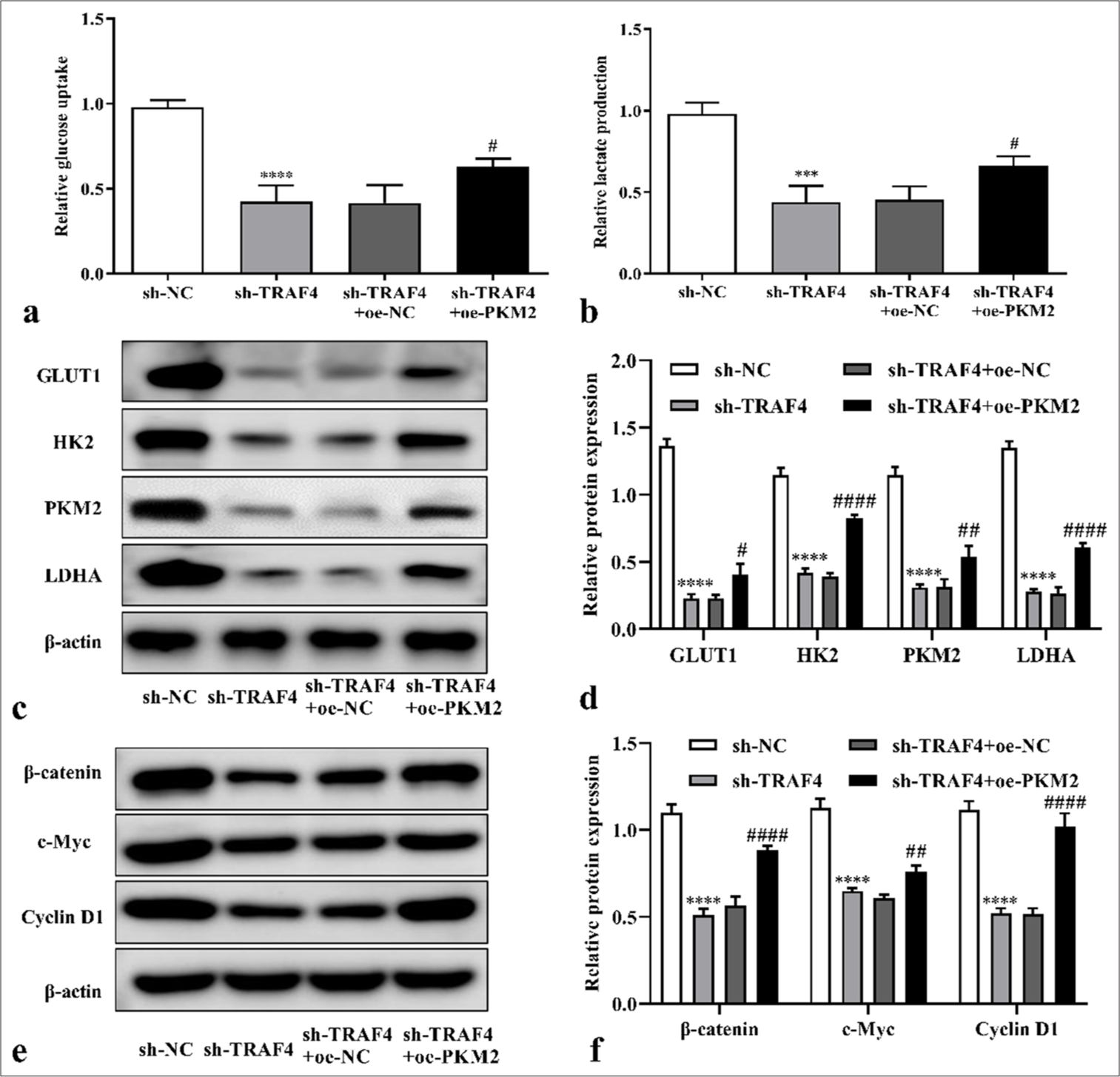 PKM2 overexpression restored effect of TRAF4 knockdown on CRC cells’ aerobic glycolysis. (a and b) After PKM2 up-regulation in cells with TRAF4 knockdown, glucose uptake and lactate production were detected (n = 3). (c-f) Glycolytic-related and Wnt/β-catenin-related proteins expression in CRC cells after sh-TRAF4 + oe-PKM2 co-transfection were detected by Western blot (n = 3). ✶✶✶P < 0.001, ✶✶✶✶P < 0.0001, versus sh-NC group. #P < 0.05, ##P < 0.01, ####P < 0.0001, versus sh-TRAF4 + oe-NC group. PKM2: Pyruvate kinase muscle isoform 2, CRC: Colorectal cancer, TRAF4: Tumor necrosis factor receptor-associated factor 4, Wnt/β: Wingless-type/beta-catenin, oe: Overexpression, NC: Negative control, sh: Short hairpin.