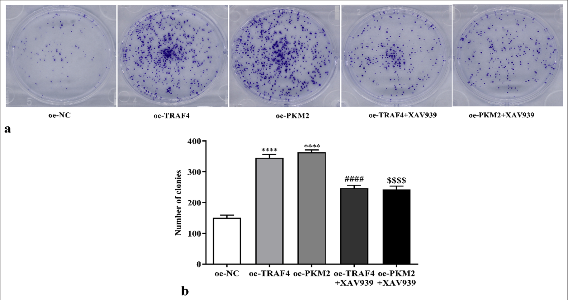 Proliferation of CRC cells with oe-TRAF4, oe-PKM2, oe-TRAF4 and XAV939, or oe-PKM2 and XAV939 treatment was measured with colony formation assay (a) clone formation images, (b) statistical analysis. (n = 3). ✶✶✶✶P < 0.0001, versus oeNC group. ####P < 0.0001, versus oe-TRAF4 group. $$$$P < 0.0001, versus oe-PKM2 group. PKM2: Pyruvate kinase muscle isoform 2, CRC: Colorectal cancer, TRAF4: Tumor necrosis factor receptor-associated factor 4, oe: Overexpression, NC: Negative control.