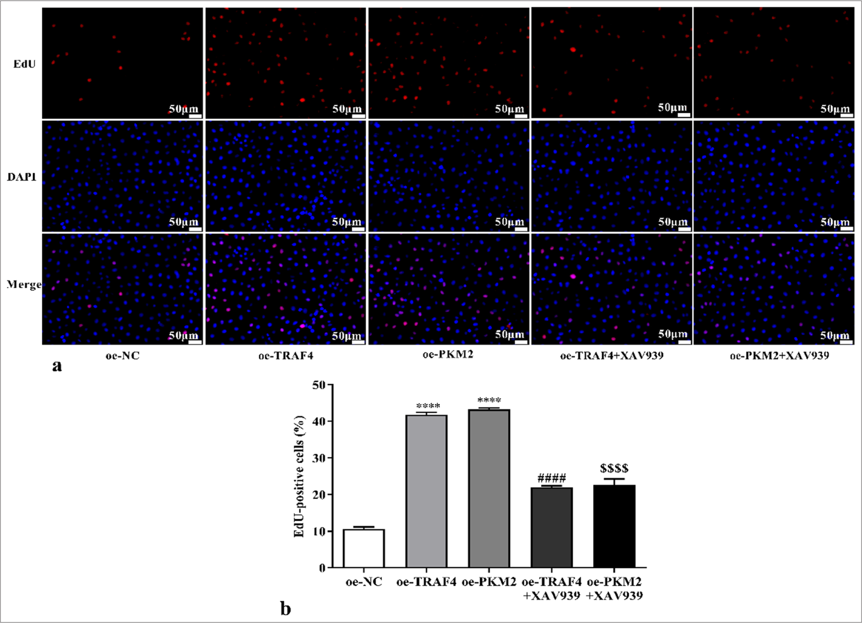 Proliferation of CRC cells with oe-TRAF4, oe-PKM2, oe-TRAF4 and XAV939, or oe-PKM2 and XAV939 treatment was measured by EdU assays (a) EdU formation images, 200×, [scale bar: 50 μm], (b) statistical analysis. (n = 3). ✶✶✶✶P < 0.0001, versus oe-NC group. ####P < 0.0001, versus oe-TRAF4 group. $$$$P < 0.0001, versus oe-PKM2 group. PKM2: Pyruvate kinase muscle isoform 2, CRC: Colorectal cancer, TRAF4: Tumor necrosis factor receptor-associated factor 4, oe: Overexpression, EdU: 5-ethynyl-2’-deoxyuridine, DAPI: 4’-6-diamidino-2-phenylindole, NC: Negative control.