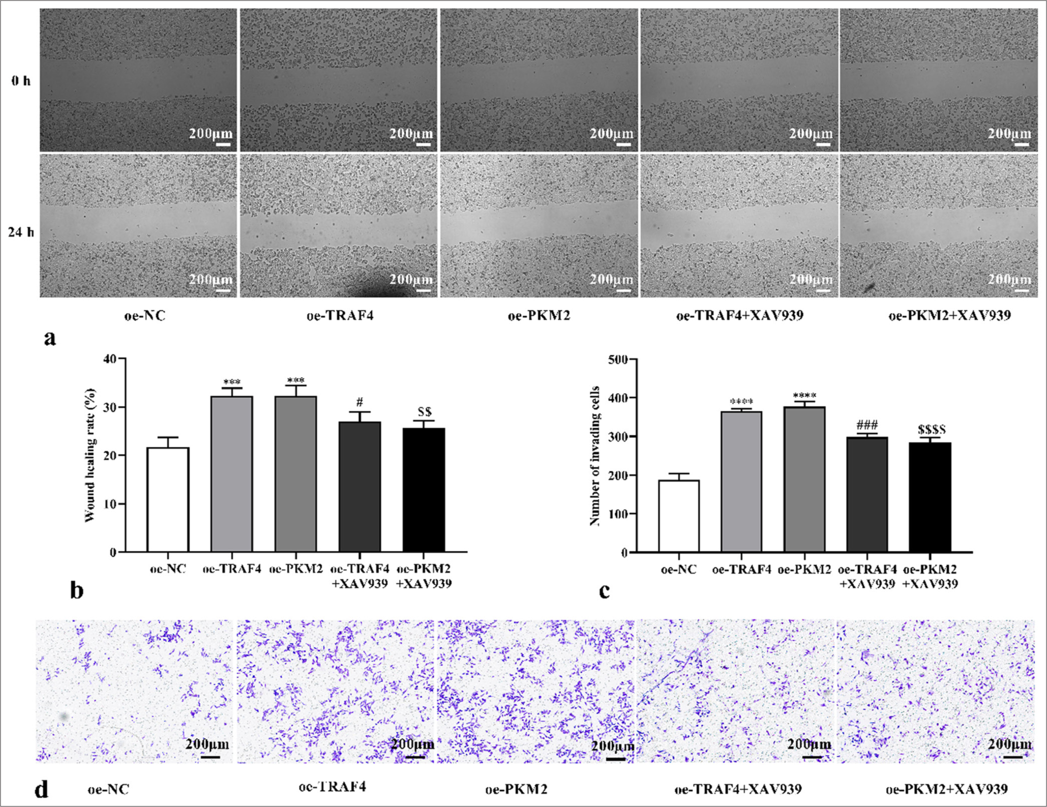 TRAF4/PKM2/Wnt/β-catenin axis mediated cell migration and invasion. (a-d) CRC cell migration and invasion with oeTRAF4, oe-PKM2, oe-TRAF4 and XAV939, or oe-PKM2 and XAV939 treatment were assessed (scale bar: 200 μm) (n = 3). ✶✶✶P < 0.001, ✶✶✶✶P < 0.0001, versus oe-NC group. #P < 0.05, ###P < 0.001, versus oe-TRAF4 group. $$P < 0.01, $$$$P < 0.0001, versus oe-PKM2 group. PKM2: Pyruvate kinase muscle isoform 2, CRC: Colorectal cancer, TRAF4: Tumor necrosis factor receptor-associated factor 4, Wnt/β: Wingless-type/beta-catenin, oe: Overexpression, NC: Negative control.