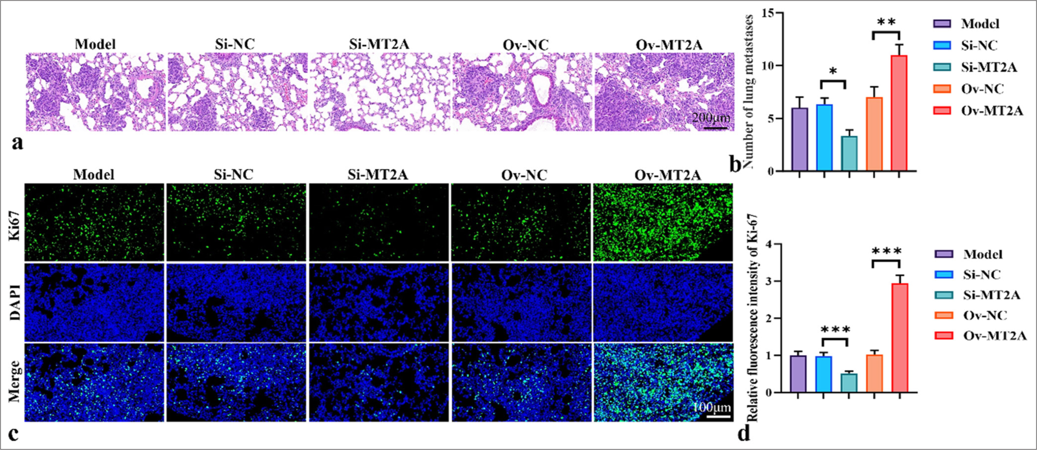 MT2A promotes lung metastasis. (a and b) Representative image and histogram of lung metastasis. (c and d) Ki67 staining diagram and fluorescence intensity histogram, objective: 200×. n = 3, ✶P < 0.05, ✶✶P < 0.01, ✶✶✶P < 0.001. MT2A: Metallothionein 2A, DAPI: 4’,6-diamidino-2-phenylindole, Si-NC: negative control to MT2A (or YAP1) small interfering RNA, Ov-NC: negative control to pCMV-MT2A.