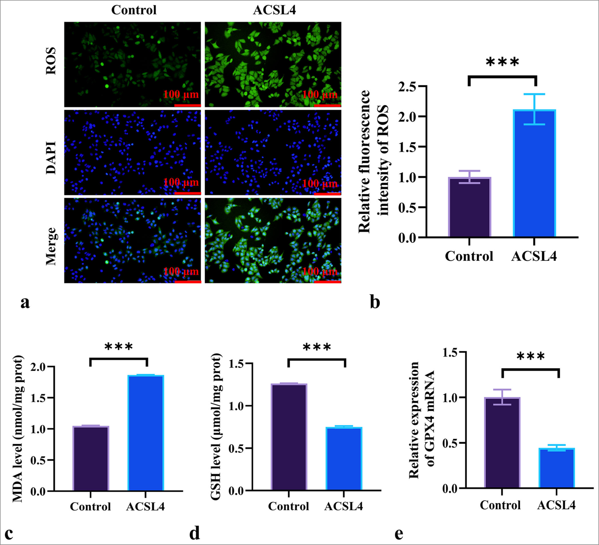 ACSL4 induces ferroptosis in EOC Cells. (a and b) Assessment of the effect of ACSL4 on ROS levels in SKOV-3 cells by ROS staining. Magnification 200×. (c and d) Measurement of MDA and GSH levels in SKOV-3 cells following ACSL4 treatment by spectrophotometric method. (e) Detection of the effect of ACSL4 on the mRNA expression level of GPX4 in SKOV-3 cells according to qRT-PCR. n = 6. ✶✶✶P < 0.001. ROS: Reactive oxygen species, MDA: Malondialdehyde, GSH: Glutathione, GPX4: Glutathione peroxidase 4, qRT-PCR: quantitative reverse transcription polymerase chain reaction, EOC: Epithelial ovarian cancer.