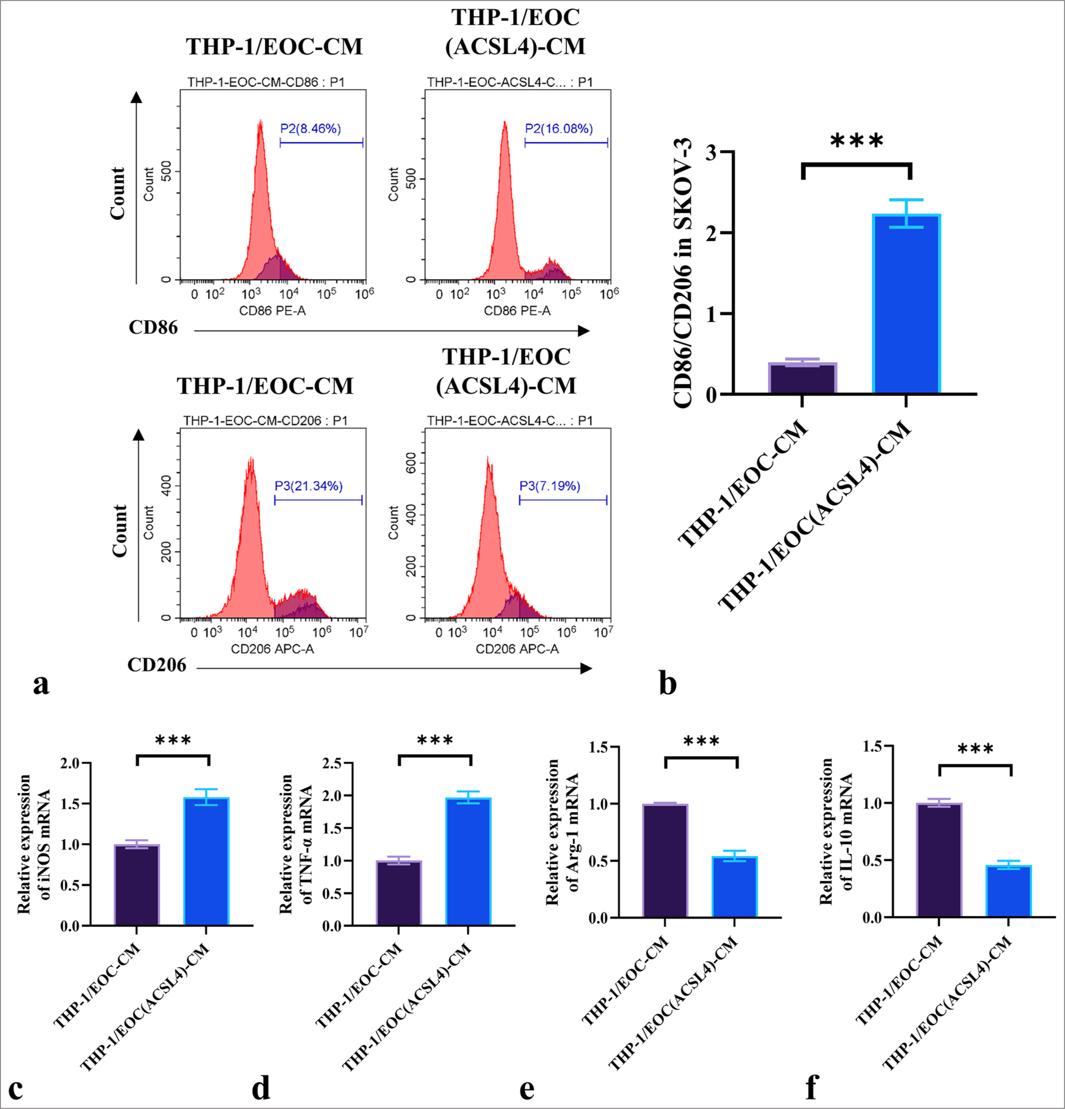 ACSL4 promotes the M1 polarization of macrophages. (a) THP-1 macrophages were treated with conditioned media from differently treated SKOV-3 cells, and the expression levels of CD86 and CD206 were measured by flow cytometry. (b) CD86/CD206 ratio. (c-f) THP-1 macrophages were treated with conditioned media from differently treated SKOV-3 cells, and the mRNA levels of iNOS, TNF-α, Arg-1, and IL-10 were measured by qRT-PCR. n = 6. ✶✶✶P < 0.001. EOC: Epithelial ovarian cancer, THP-1/EOC-CM: THP-1 cells treated with EOC cell culture medium, THP-1/EOC (ACSL4)-CM: THP-1 cells treated with EOC cell culture medium pretreated with ACSL4, CD86: Cluster of differentiation 86, CD206: Cluster of differentiation 206, iNOS: Inducible nitric oxide synthase, TNF-α: Tumor necrosis factor-α, Arg-1: Arginase-1, IL-10: Interleukin-10, qRT-PCR: quantitative reverse transcription polymerase chain reaction, EOC: Epithelial ovarian cancer.