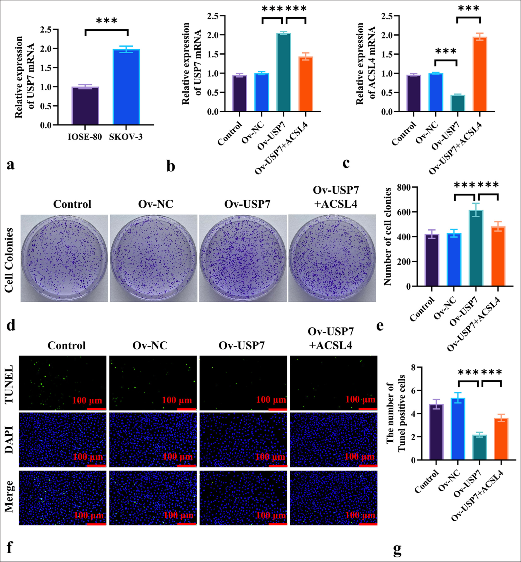 ACSL4 Reverses USP7-Induced Proliferation in EOC Cells. (a) The mRNA levels of USP7 in ovarian epithelial cells (IOSE-80) and EOC cells (SKOV-3) were measured by qRT-PCR. (b) The transfection of SKOV-3 cells with USP7 overexpression vector and treatment with ACSL4 recombinant protein, showing the mRNA levels of USP7 in the SKOV-3 cells. (c) The mRNA levels of ACSL4 in the SKOV-3 cells was detected by qRT-PCR. (d and e) The assessed effects of ACSL4 and USP7 on colony formation in the SKOV-3 cells. (f and g) The effects of ACSL4 and USP7 on apoptosis in the SKOV-3 cells were measured by TUNEL staining. Magnification 200×. n = 6. ✶✶✶P < 0.001. USP7: Ubiquitin-specific protease 7, Ov-NC: Overexpression-negative control, Ov-USP-7: Overexpression-USP7, qRT-PCR: quantitative reverse transcription polymerase chain reaction, EOC: Epithelial ovarian cancer.