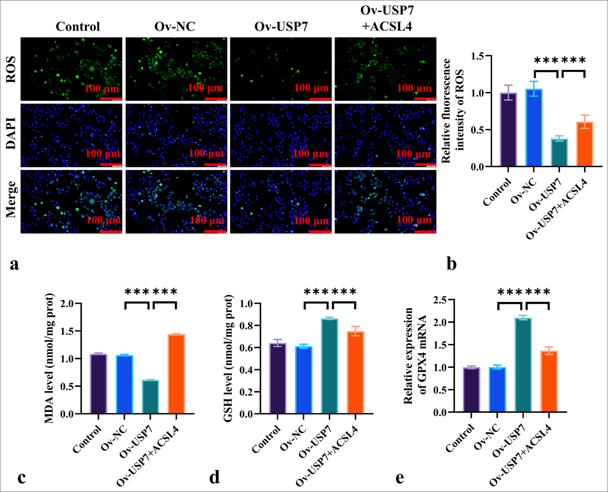 ACSL4 Reverses USP7-Induced Ferroptosis Resistance in EOC Cells. (a and b) Assessment of the effects of ACSL4 and USP7 on ROS levels in the SKOV-3 cells by ROS staining, magnification 200×. (c and d) The measurement of MDA and GSH levels in the SKOV-3 cells treated with ACSL4 and USP7 through ELISA. (e) The evaluation of the effects of ACSL4 and USP7 on the mRNA expression levels of GPX4 in SKOV-3 cells through qRT-PCR. Magnification 200×. n = 6. ✶✶✶P < 0.001. qRT-PCR: Quantitative reverse transcription polymerase chain reaction, EOC: Epithelial ovarian cancer.