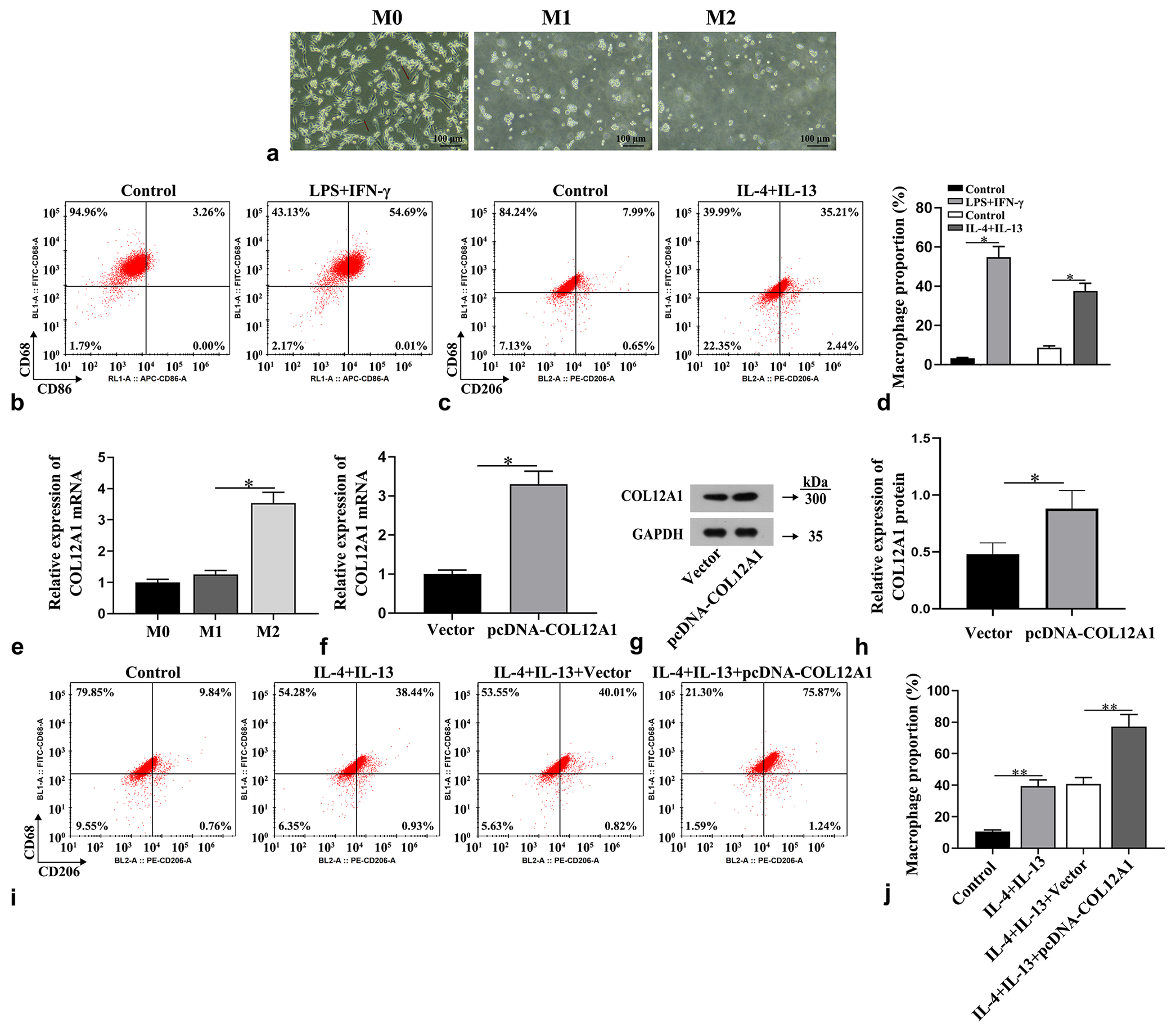 Promotion of macrophage M2 polarization by overexpression of COL12A1. (a) Examination of the morphology of macrophages using optical microscopy (Magnification 40×). (b-d) Flow cytometry used to determine the proportion of M1 and M2 macrophages. (e) Detection of COL12A1 mRNA expression by RT-qPCR. (f-h) Detection of COL12A1 overexpression efficiency. (i and j) Flow cytometry used to determine the proportion of M2 macrophages. ✶P < 0.05 and ✶✶P < 0.01. Scale bar = 100 μm. CD: Cluster of differentiation, IL: Interleukin. Statistical analysis of significance using one-way ANOVA or Student’s t-test. COL12A1: Collagen type XII alpha 1 chain, mRNA: Messenger RNA, ANOVA: Analysis of variance, RT-qPCR: Quantitative real-time polymerase chain reaction.