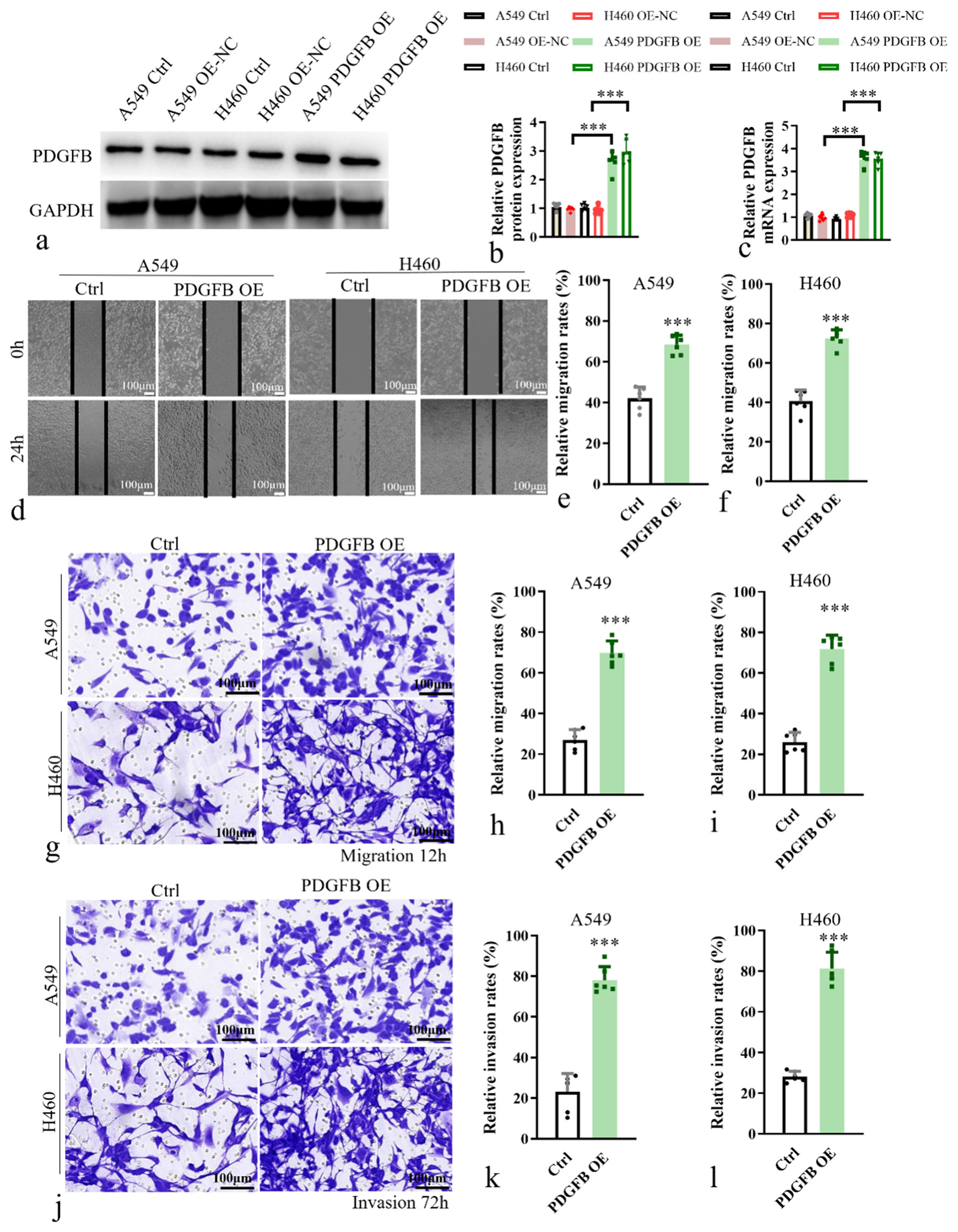 Platelet-derived growth factor subunit B overexpression promotes lung ...