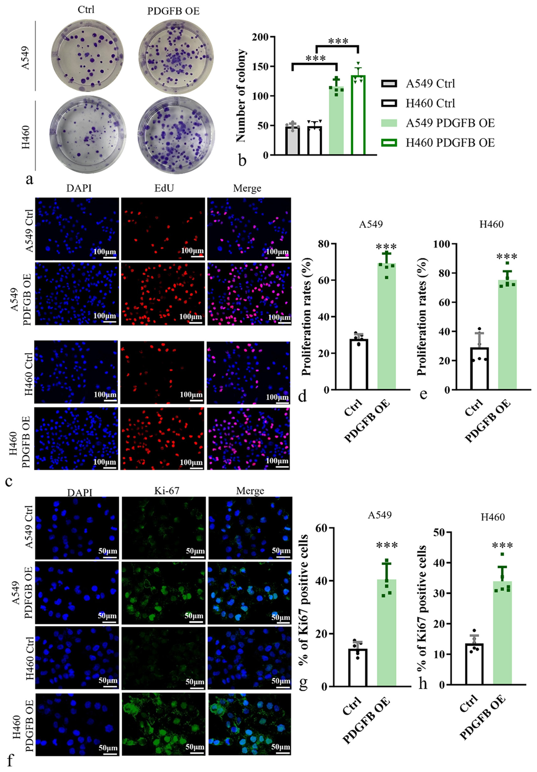 Impact of PDGFB overexpression on the proliferation ability of lung cancer cells. (a and b) Analysis of proliferation ability of A549 and H460. (c-e) EdU incorporation assay, objective: 200×, was performed in A549 and H460. Scale bars, 100 μm. (f-h) Staining of Ki67 antibody in A549 and H460, objective: 200×. Scale bars, 50 μm. n = 6. ✶✶✶P < 0.001. EdU: 5-ethynyl-2’-deoxyuridine, PDGFB: Platelet-derived growth factor subunit B.