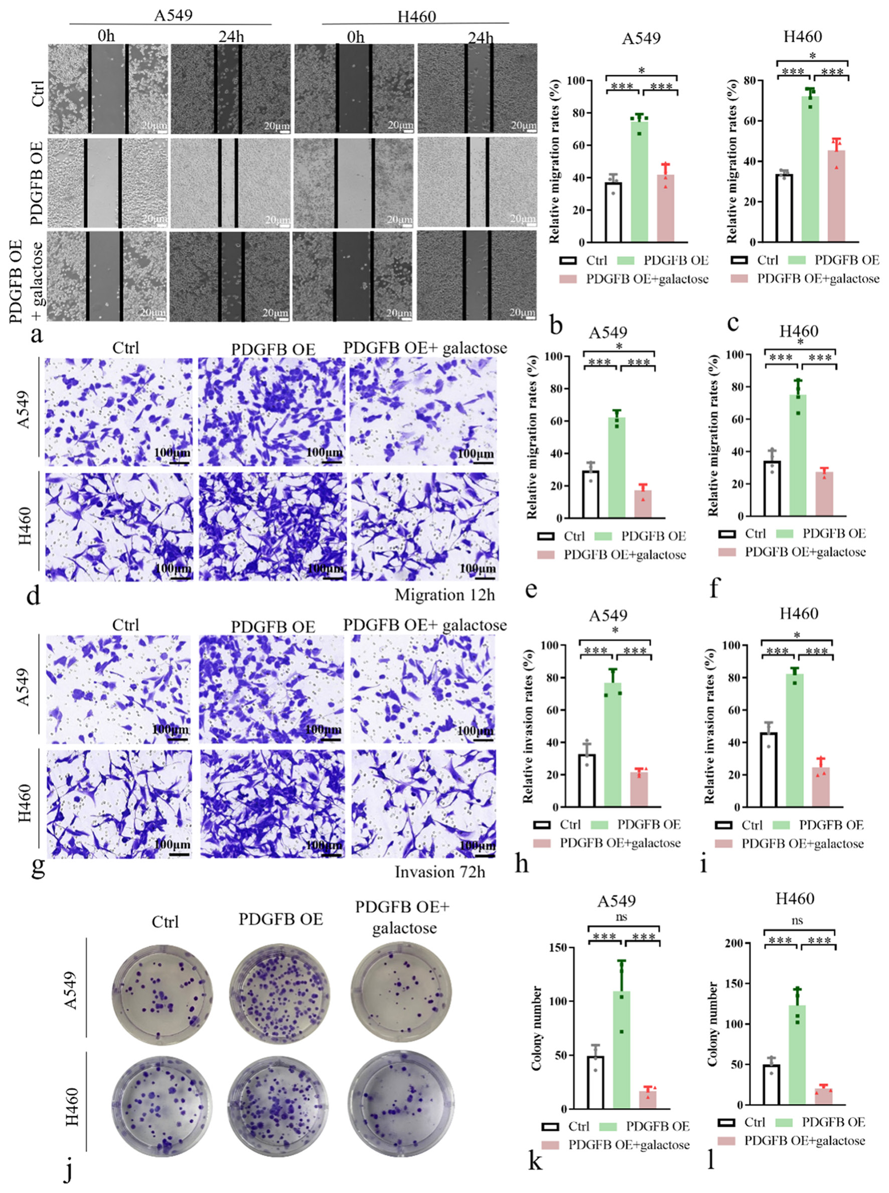 Platelet-derived growth factor subunit B overexpression promotes lung ...