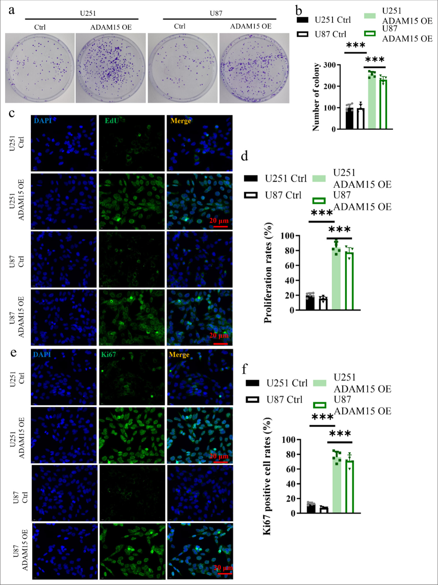 Impact of ADAM15 overexpression on the proliferation ability of glioblastoma cells. (a) Measurement of colony number in U251 and U87. (b) Clonogenic assay in U251 and U87. (c) EdU incorporation in U251 and U87. Scale bar = 20 μm. Objective: 400×. (d) Proliferation rates in U251 and U87 for EdU incorporation. (e) Evaluation of Ki67 immunohistochemistry staining. Scale bar = 20 μm. Objective: 400×. (f) Ki67 positive cell rates in U251 and U87 for Ki67 immunohistochemistry staining. n = 5 independent replicates. ✶✶✶ P < 0.001. ADAM15: A disintegrin-like and metalloproteinase 15.