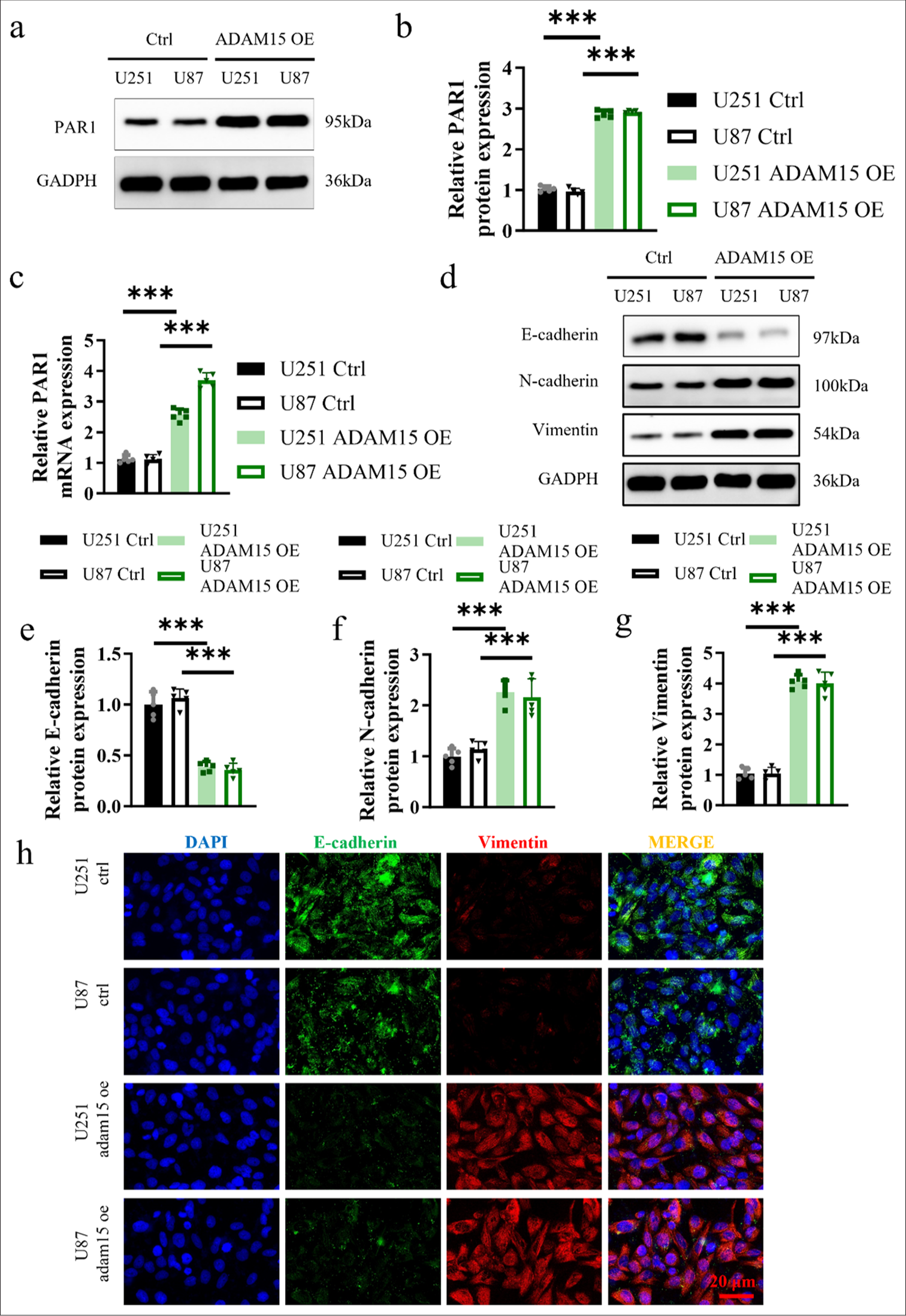 Impacts of ADAM15 overexpression on PAR1 expression and EMT. (a and b) Measurement of PAR1 protein expression in U251 and U87. (c) Measurement of PAR1 mRNA expression in U251 and U87. (d) Measurement of E-cadherin, N-cadherin, and Vimentin protein expression in U251 and U87. (e) Relative E-cadherin protein expression in U251 and U87. (f) Relative N-cadherin protein expression in U251 and U87. (g) Relative Vimentin protein expression in U251 and U87. (h) Immunofluorescence of E-cadherin and Vimentin staining in U251 and U87. Scale bar = 20 μm. Objective: 400×. n = 5 independent replicates. ✶✶✶ P < 0.001. ADAM15: A disintegrin-like and metalloproteinase 15, PAR1: Protease-activated receptor 1, Epithelial-mesenchymal transition, mRNA: Messenger RNA.