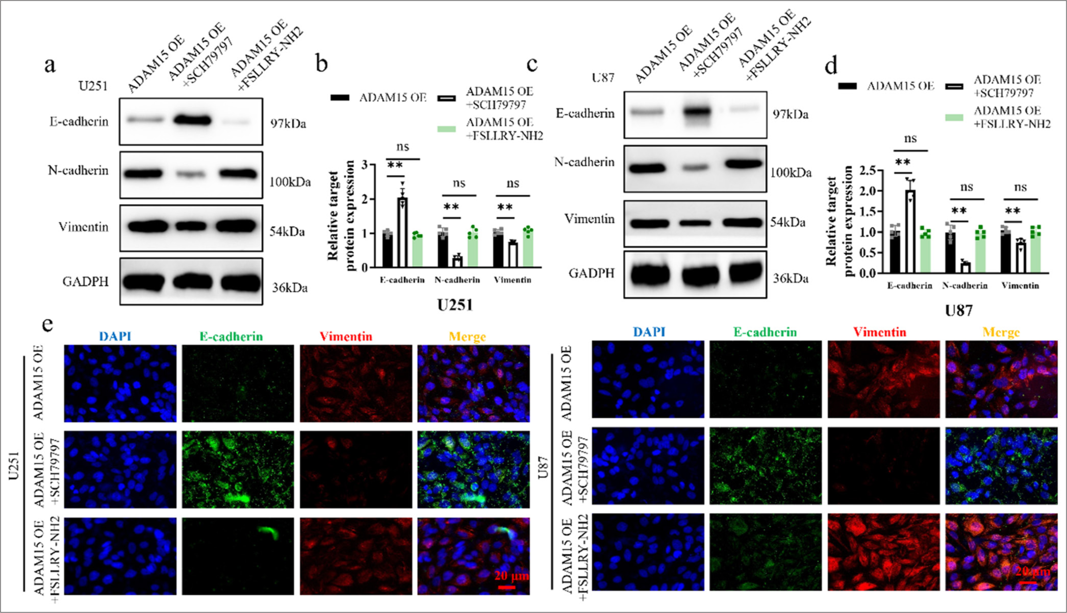 Inhibition of ADAM15-induced EMT by PAR-1 antagonist treatment. (a) Western blotting of E-cadherin, N-cadherin, and Vimentin protein expression after PAR-1 antagonist SCH79797 or PAR-2 antagonist FSLLRY-NH2 treatment in U251. (b) Histogram of E-cadherin, N-cadherin, and Vimentin protein expression in U251. (c) Western blotting of E-cadherin, N-cadherin, and Vimentin protein expression after PAR-1 antagonist SCH79797 or PAR-2 antagonist FSLLRY-NH2 treatment in U87. (d) Histogram of E-cadherin, N-cadherin, and Vimentin protein expression in U87. (e) Immunofluorescence of E-cadherin and Vimentin staining in U251 and U87. Scale bar = 20 μm. Objective: 400×. n = 5 independent replicates. ns: Not significant, ✶✶P < 0.01. ADAM15: A disintegrin-like and metalloproteinase 15, PAR1: Protease-activated receptor 1, Epithelial-mesenchymal transition.