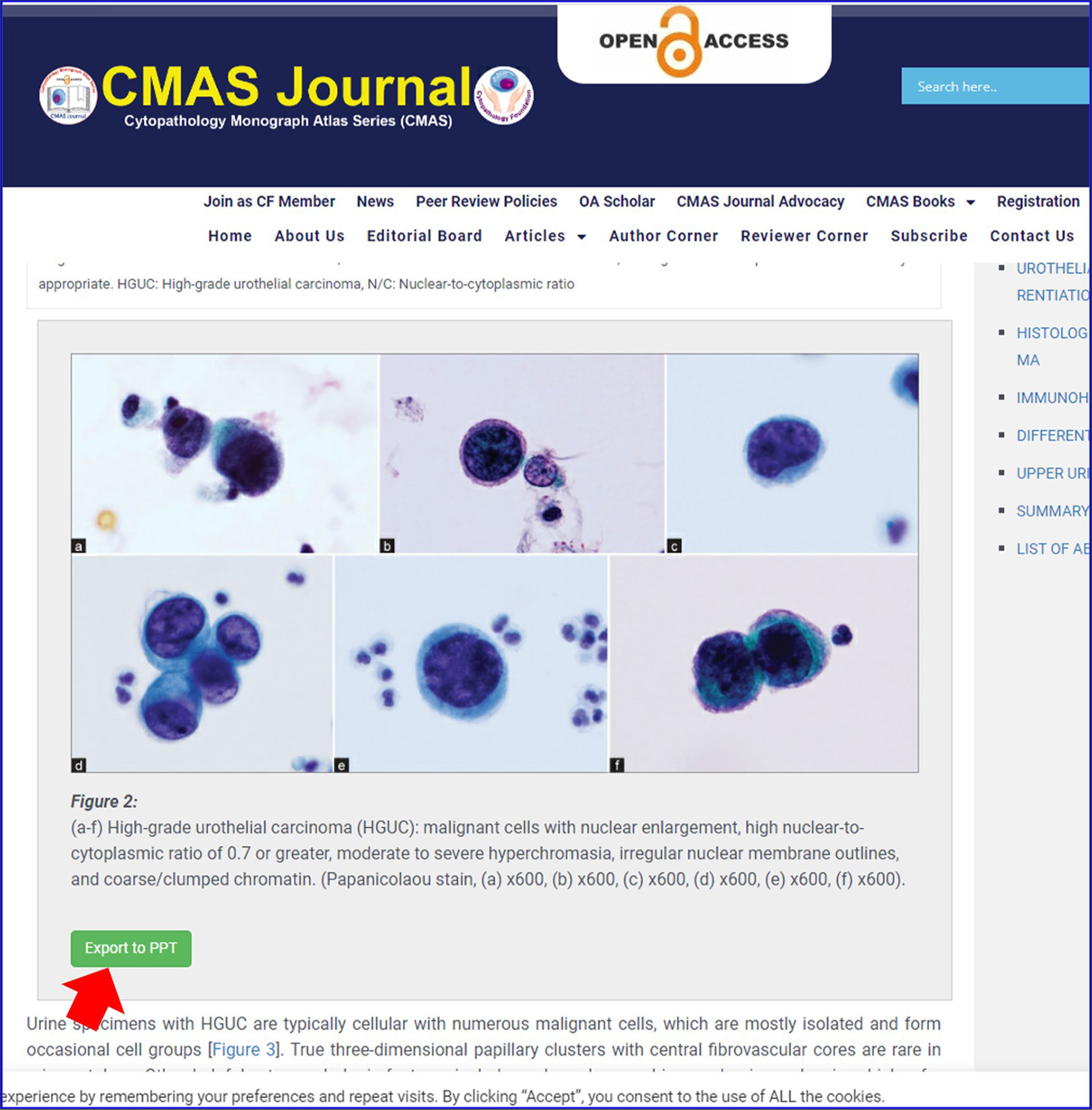 Easy importing of images to PowerPoint presentation (PPT) with a single click of green button “Export to PPT” (red arrow) feature in HTML version with CMAS Journal articles.