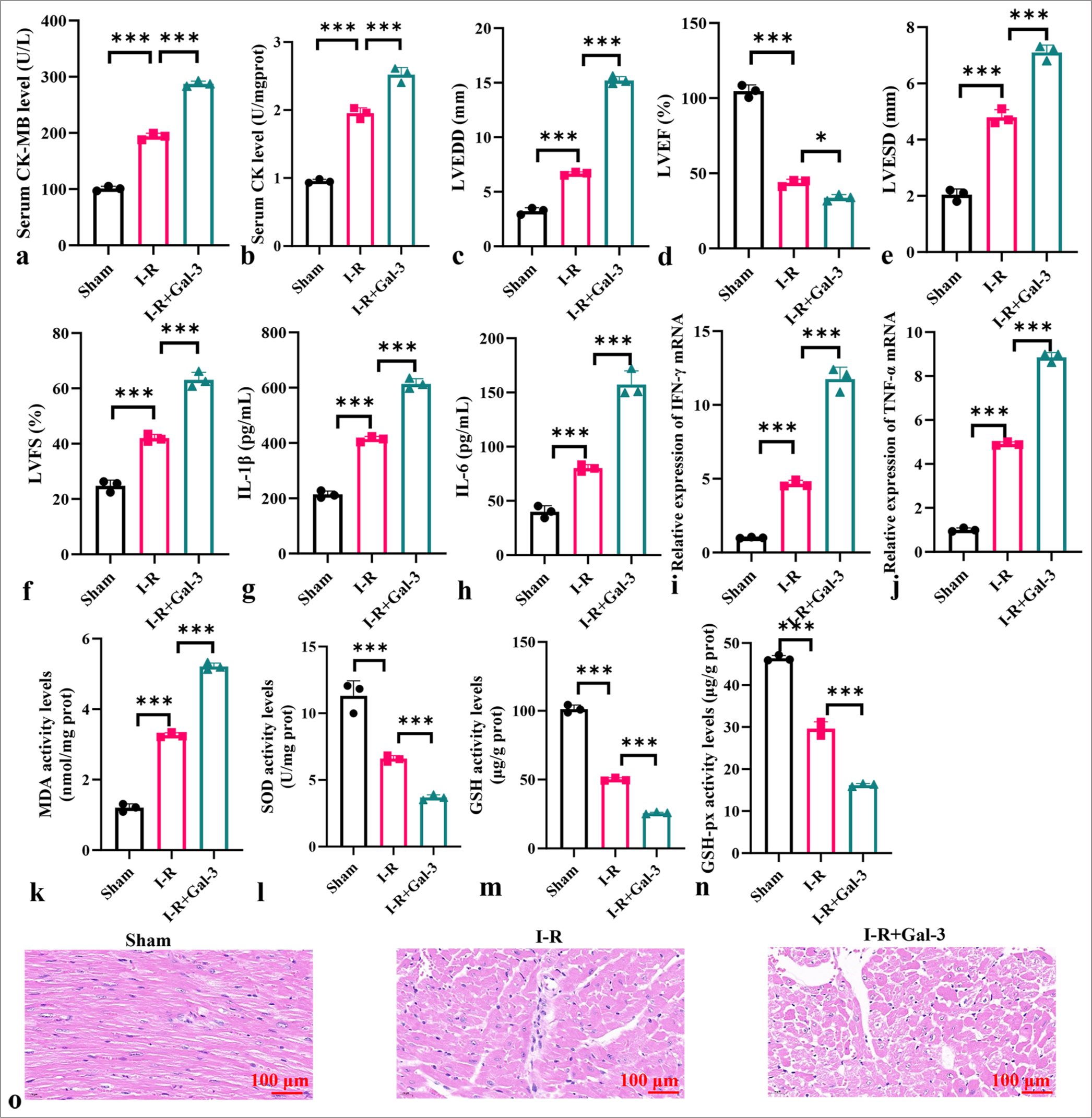 Galectin-3 enhances oxidative stress and inflammatory response in an in vivo myocardial I-R model. (a and b) Levels of CK-MB (a) and CK (b) in serum. (c) LVEDD. (d) LVEF. (e) LVESD. (f) LVFS. (g-j) Levels of IL-1b, IL-6, TNF-a, and IFN-g in myocardial I-R tissues. (k-n) Levels of MDA, SOD, GSH, and GSH-px in myocardial tissues. (o) HE staining of myocardial I-R tissues. Objective: ×200. Scale bar = 100 μm. (n = 3, ✶P < 0.05, ✶✶✶P < 0.001). I-R: Ischemia-reperfusion, CK: Creatine kinase, CK-MB: creatine kinasemyocardial band, LVEF: Left ventricular ejection fraction, LVESD: Left ventricular end-systolic dimension, LVFS: Left ventricular fractional shortening, LVEDD: Left ventricular end-diastolic diameter, IL: Interleukin, TNF-a: Tumor necrosis factor alpha, IFN-g: Interferon gamma, MDA: Malondialdehyde, SOD: Superoxide dismutase, GSH: Glutathione, GSH-Px: Glutathione peroxidase, HE: Hematoxylin-eosin.