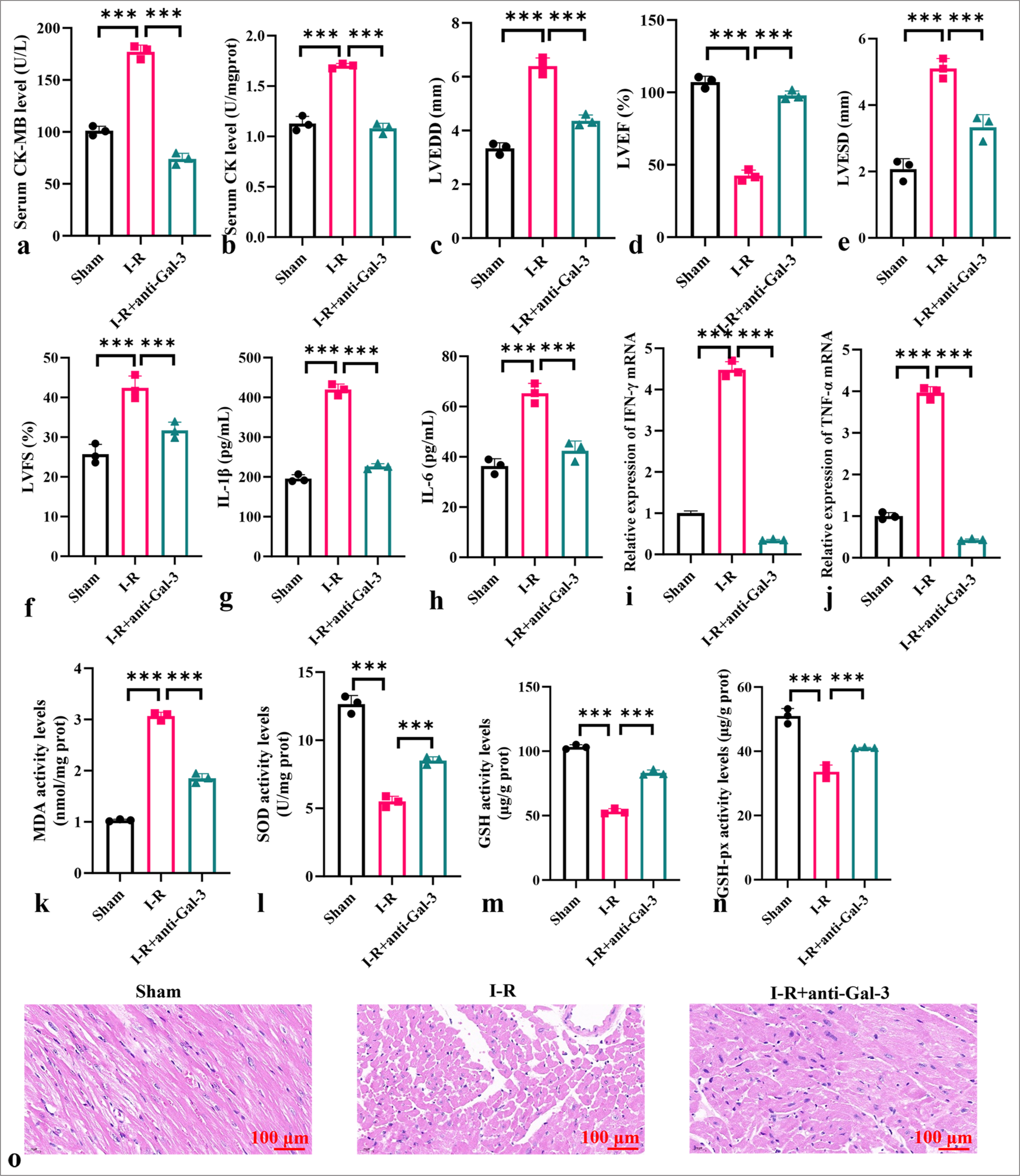 Anti-galectin-3 attenuates oxidative stress and inflammatory response in myocardial I-R model. (a and b) Levels of CK-MB (a) and CK (b) in serum. (c) LVEDD. (d) LVEF. (e) LVESD. (f) LVFS. (g-j) Levels of IL-1b, IL-6, TNF-a, and IFN-g in myocardial tissues. (k-n) Levels of MDA, SOD, GSH, and GSH-px in myocardial tissues. (o) HE staining of myocardial I-R tissues. Objective: ×200. Scale bar = 100 μm. (n = 3, ✶✶✶P < 0.001). I-R: Ischemia-reperfusion, CK: Creatine kinase, CK-MB: creatine kinase-myocardial band, LVEF: Left ventricular ejection fraction, LVESD: Left ventricular end-systolic dimension, LVFS: Left ventricular fractional shortening, LVEDD: Left ventricular enddiastolic diameter, IL: Interleukin, TNF-a: Tumor necrosis factor alpha, IFN-g: Interferon gamma, MDA: Malondialdehyde, SOD: Superoxide dismutase, GSH: Glutathione, GSH-Px: Glutathione peroxidase, HE: Hematoxylin-eosin.