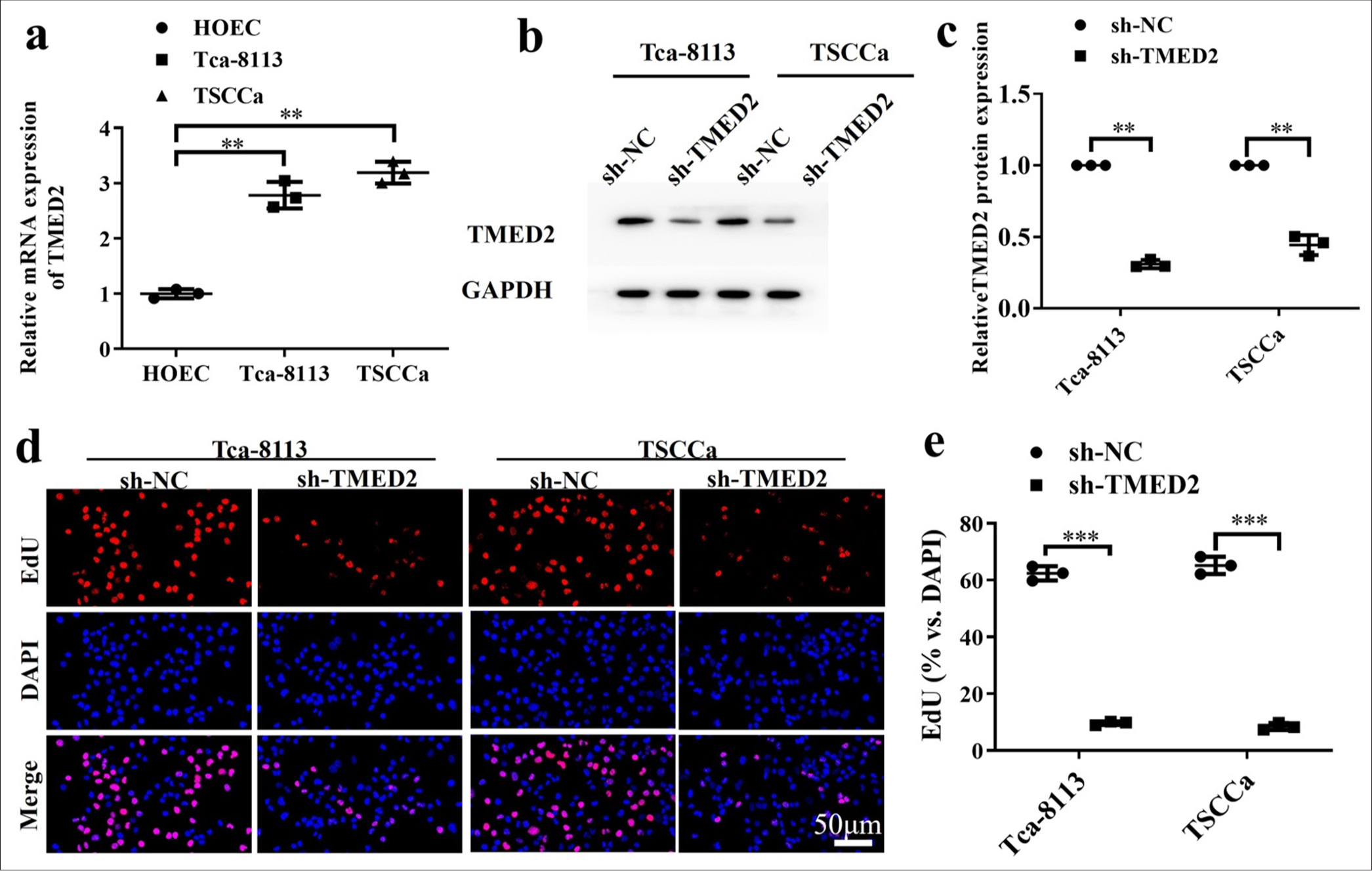 TMED2 promotes proliferation of OC cells in vitro. (a) TMED2 expression levels in HOECs, Tca-8113, and TSCCa by qRTPCR. (b) TMED2 in OC cells. (c) TMED2 protein levels in OC cells. (d and e) Assessment of proliferation activity by EdU assay. n = 3, ✶✶P < 0.01, ✶✶✶P < 0.001. TMED2: Transmembrane Emp24 domain containing 2, OC: Oral cancer, HOEC: Human oral epithelial cell, qRTPCR: Quantitative real-time polymerase chain reaction, sh-NC: negative control to TMED2 shRNA, sh-TMED2: TMED2 shRNA , GAPDH: Glyceraldehyde-3-phosphate dehydrogenase, DAPI: 4’,6-diamidino-2-phenylindole, EdU: 5-ethynyl-2'-deoxyuridine.