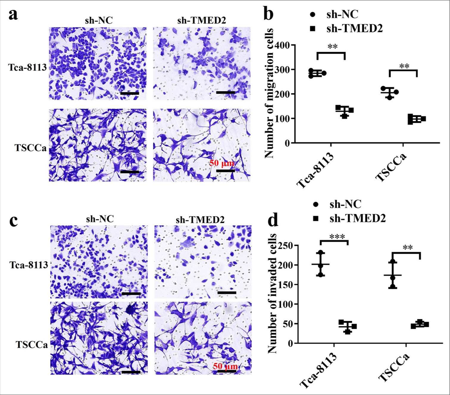 TMED2 promotes migration and invasion of OC cells in vitro. (a and b) Migration of Tca-8113 and TSCCa cells transfected with sh-TMED2. (c and d) Invasion of Tca-8113 and TSCCa cells transfected with sh-TMED2. n = 3, ✶✶P < 0.01, ✶✶✶P < 0.001.