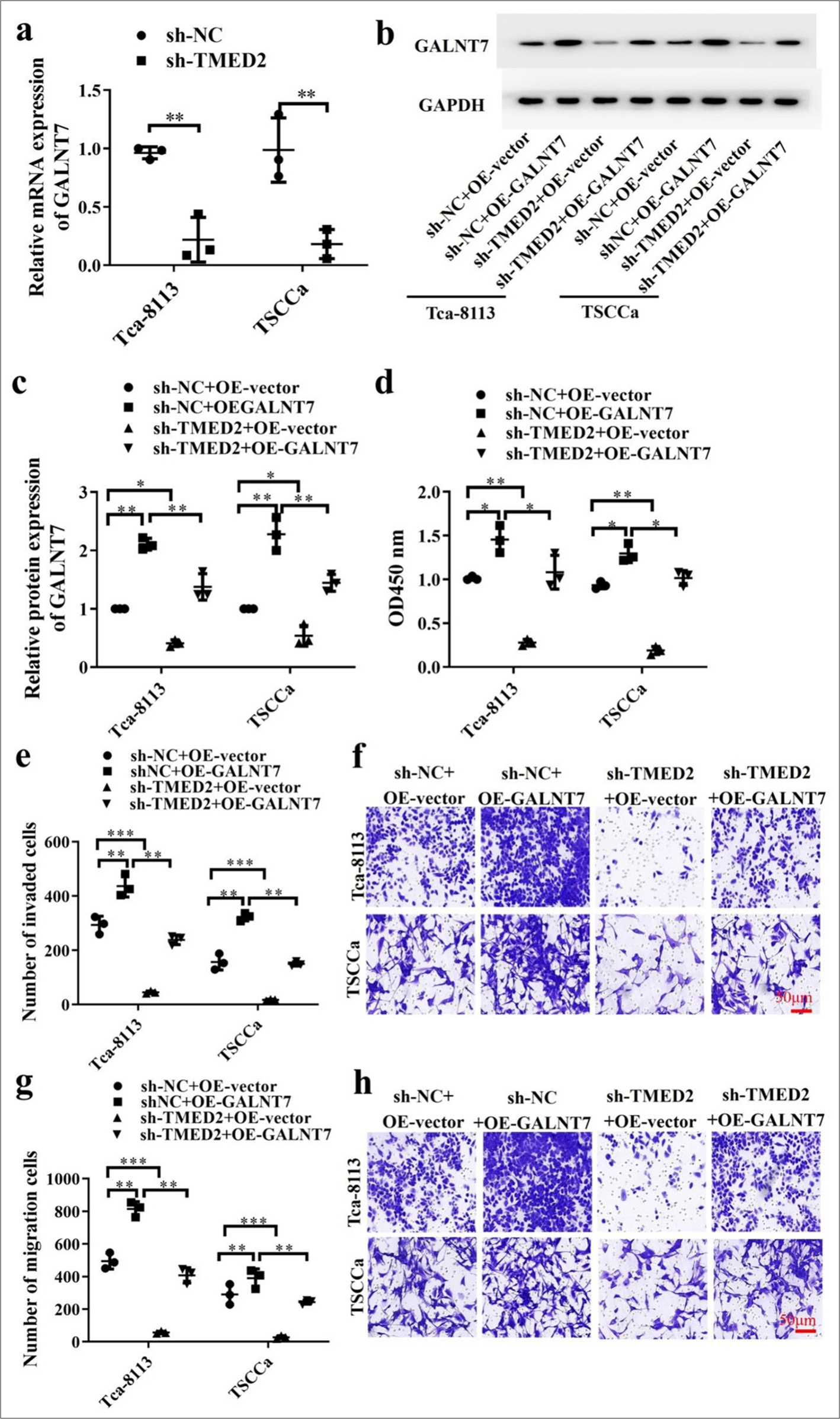 TMED2 regulates GALNT7 expression in OC. (a) Measurement of GALNT7 in OC cells with sh-TMED2. (b) Measurement of GALNT7 protein levels. (c) Statistical analysis of GALNT7 protein levels. (d) Assessment of proliferation activity by CCK-8 assay. (e-h) Migration and invasion of OC cells transfected with sh-NC+OE-vector, sh-NC+OE-GALNT7, sh-TMED2+OE-vector, or sh-TMED2+OE-GALNT7. Scale bar: 50 μm. n = 3, ✶P < 0.05, ✶✶P < 0.01, ✶✶✶P < 0.001. GALNT7: Polypeptide-N-acetylgalactosaminyltransferase 7, CCK-8: Cell counting kit-8.