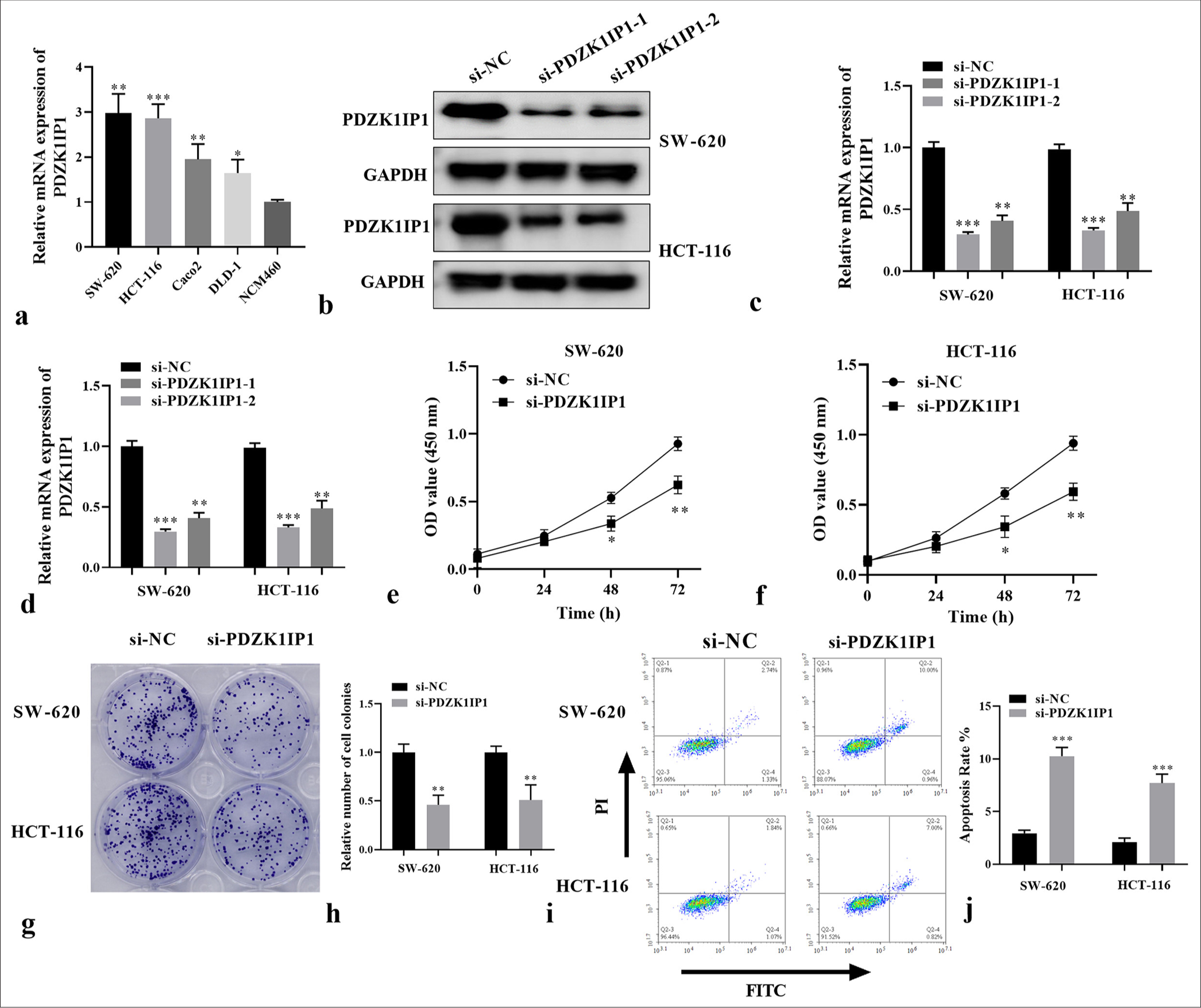 PDZK1IP1 silencing restrained cell proliferation and promoted apoptosis in CRC. (a) The messenger RNA expression of PDZK1IP1 was examined by RT-qPCR in the CRC cells. (b-d) The protein expression of PDZK1IP1 was detected by Western blot and RT-qPCR after transfection. (e-h) The function of PDZK1IP1 on cell proliferation was evaluated by CCK-8 and colony formation assay. (i and j) Flow cytometric analysis of apoptosis in PDZK1IP1-knockdown SW-620 and HCT-116 cells. ✶P < 0.05, ✶✶P < 0.01, ✶✶✶P < 0.001. Experiments were performed in triplicate, and each experiment was repeated 3 times. PDZK1IP1: PDZK1-interacting protein 1, CRC: Colorectal carcinoma, RT-qPCR: Reverse transcription-quantitative polymerase chain reaction, CCK-8: Cell counting kit-8, si-NC: Small interfering negative control, GAPDH: Glyceraldehyde-3-phosphate dehydrogenase, FITC, Fluorescein isothiocyanate.