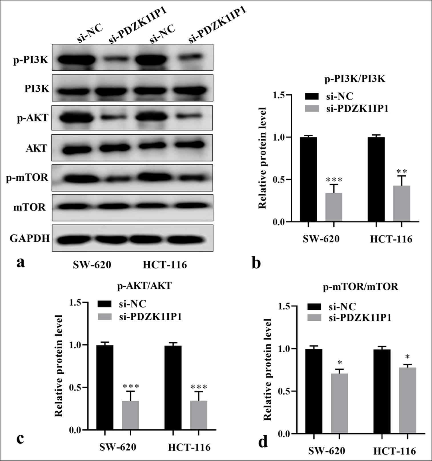 PDZK1IP1 knockdown inhibited the PI3K/AKT/mTOR pathway of CRC cells. (a) Representative image of Western blot. (b-d) Relative protein levels of critical proteins in the PI3K/AKT/mTOR signaling pathway were detected by Western blot after PDZK1IP1 knockdown. ✶P < 0.05, ✶✶P < 0.01, ✶✶✶P < 0.001. Experiments were performed in triplicate, and each experiment was repeated 3 times. PDZK1IP1: PDZK1-interacting protein 1, CRC: Colorectal carcinoma, PI3K/AKT/mTOR: Phosphatidylinositol 3-kinase/protein kinase B/mechanistic target of rapamycin, si-NC: Small interfering negative control, GAPDH: Glyceraldehyde-3-phosphate dehydrogenase, p-AKT: Phosphorylated Protein Kinase B, p-mTOR: Phosphorylated mechanistic target of rapamycin.