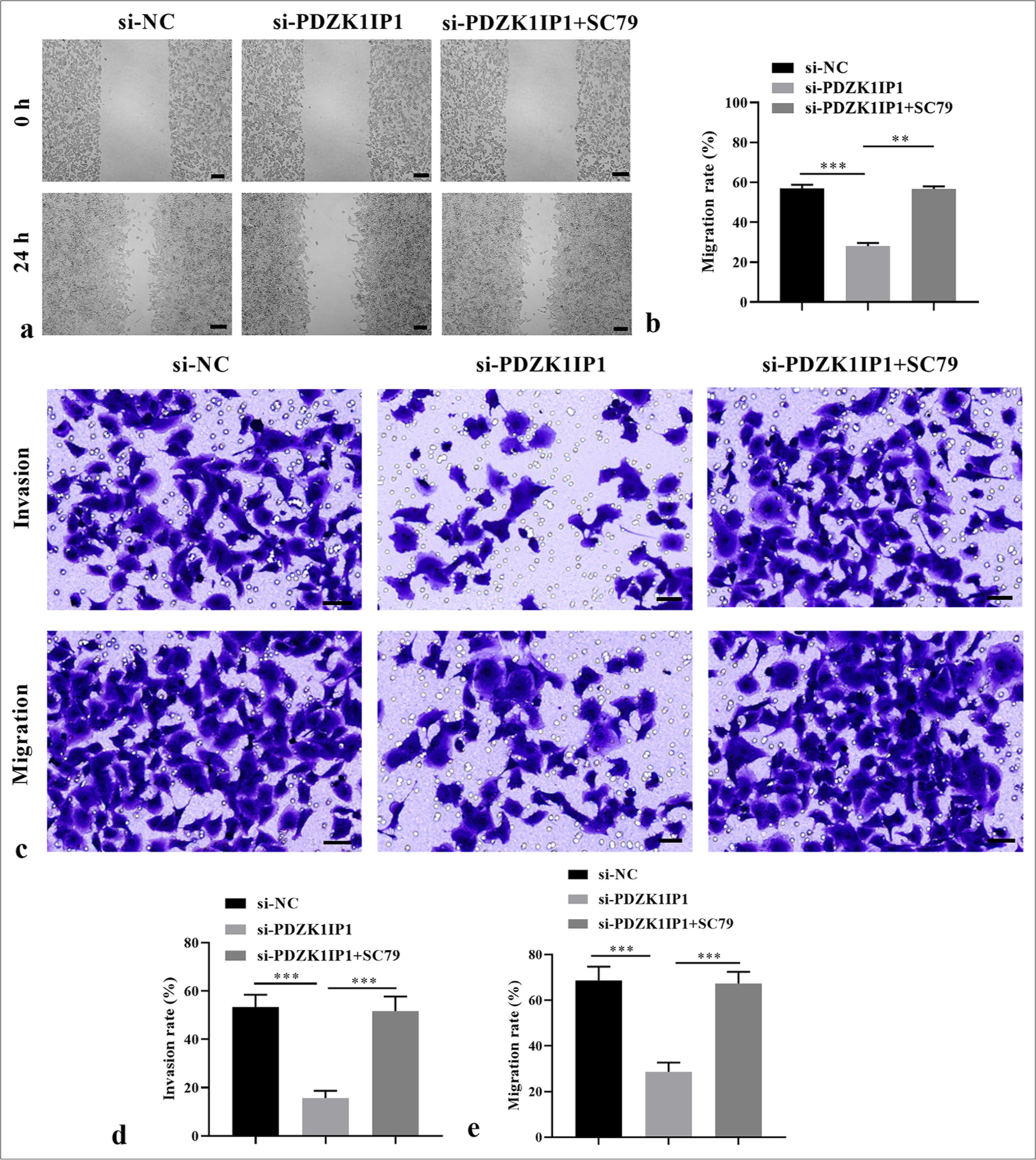 PDZK1IP1 knockdown inhibited CRC cell migration and invasion by inhibiting the PI3K/AKT/mTOR pathway. (a and b) The function of PDZK1IP1 and SC79 on the migration of CRC cells was evaluated by scratch healing assay. Scale bar = 200 μm, magnification × 40. (c-e) The function of PDZK1IP1 and SC79 on migration and invasion of CRC cells was evaluated by Transwell assay. Scale bar = 100 μm, magnification × 200. ✶✶P < 0.01, ✶✶✶P < 0.001. Experiments were performed in triplicate, and each experiment was repeated 3 times. PDZK1IP1: PDZK1-interacting protein 1, CRC: Colorectal carcinoma, PI3K/AKT/mTOR: Phosphatidylinositol 3-kinase/protein kinase B/mechanistic target of rapamycin, si-NC: Small interfering negative control.