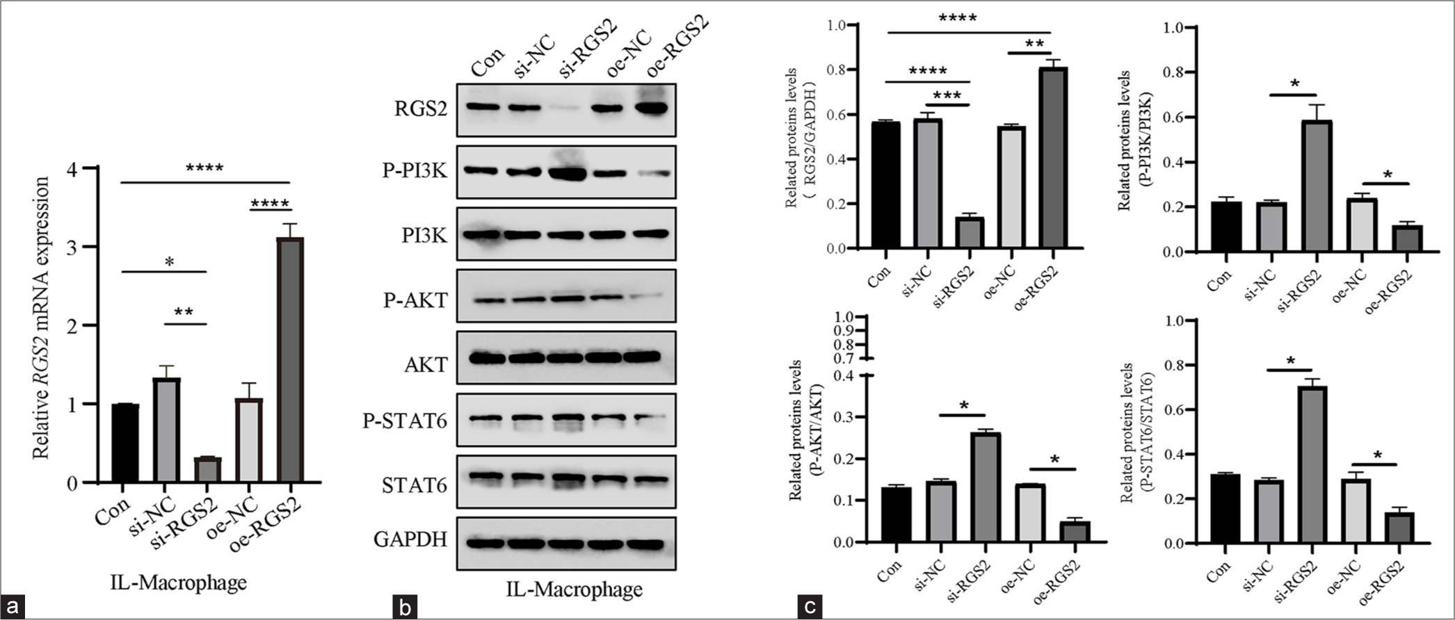 Effects of RGS2 on the PI3K/AKT/STAT6 axis in M2 macrophages. (a) qPCR confirmed the efficiency of oe-RGS2 and si-RGS2. (b and c) Phosphorylation levels of PI3K, AKT, and STAT6 in M2 macrophages following the overexpression or silencing of RGS2. All data are presented as mean ± standard deviation. ✶P < 0.05; ✶✶P < 0.01; ✶✶✶P < 0.001; ✶✶✶✶P < 0.0001. RGS2: Regulator of G-protein signaling 2, PGE2: Prostaglandin E2, AKT: Protein kinase B, PI3K: Phosphatidylinositol-3 kinase, oe-RGS2: RGS2 overexpression, si-RGS2: RGS2 silencing, qPCR: Quantitative polymerase chain reaction, STAT6: Signal transducer and activator 6.